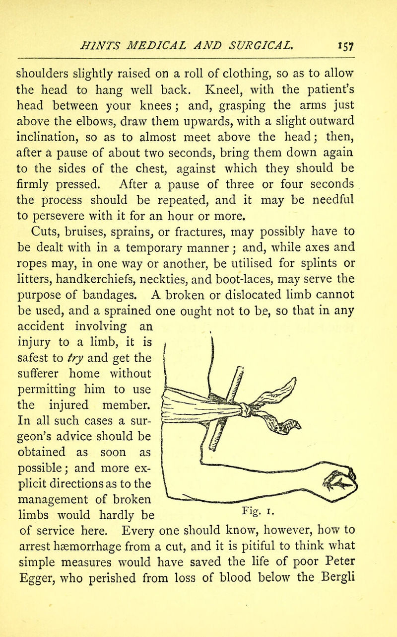shoulders slightly raised on a roll of clothing, so as to allow the head to hang well back. Kneel, with the patient’s head between your knees ; and, grasping the arms just above the elbows, draw them upwards, with a slight outward inclination, so as to almost meet above the head; then, after a pause of about two seconds, bring them down again to the sides of the chest, against which they should be firmly pressed. After a pause of three or four seconds the process should be repeated, and it may be needful to persevere with it for an hour or more. Cuts, bruises, sprains, or fractures, may possibly have to be dealt with in a temporary manner; and, while axes and ropes may, in one way or another, be utilised for splints or litters, handkerchiefs, neckties, and boot-laces, may serve the purpose of bandages. A broken or dislocated limb cannot be used, and a sprained one ought not to b.e, so that in any accident involving an injury to a limb, it is safest to try and get the sufferer home without permitting him to use the injured member. In all such cases a sur- geon’s advice should be obtained as soon as possible; and more ex- plicit directions as to the management of broken limbs would hardly be of service here. Every one should know, however, how to arrest haemorrhage from a cut, and it is pitiful to think what simple measures would have saved the life of poor Peter Egger, who perished from loss of blood below the Bergli