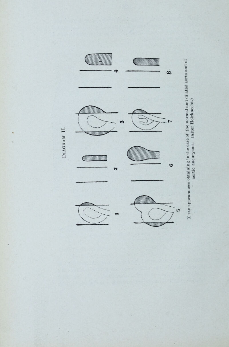 X ray appearances obtaining in the case of the nor