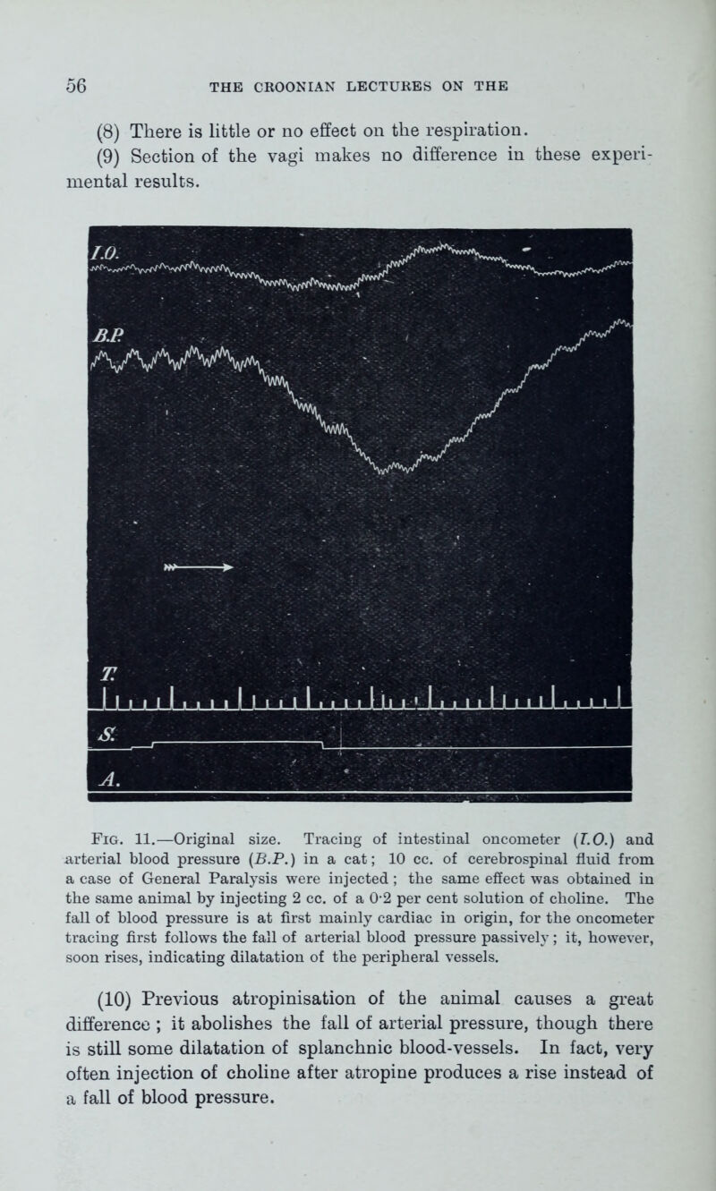 (8) There is little or no effect on the respiration. (9) Section of the vagi makes no difference in these experi- mental results. Fig. 11.—Original size. Tracing of intestinal oncometer (T.O.) and arterial blood pressure (B.P.) in a cat; 10 cc. of cerebrospinal fluid from a case of General Paralysis were injected; the same effect was obtained in the same animal by injecting 2 cc. of a 0-2 per cent solution of choline. The fall of blood pressure is at first mainly cardiac in origin, for the oncometer tracing first follows the fall of arterial blood pressure passively; it, however, soon rises, indicating dilatation of the peripheral vessels. (10) Previous atropinisation of the animal causes a great difference ; it abolishes the fall of arterial pressure, though there is still some dilatation of splanchnic blood-vessels. In fact, very often injection of choline after atropine produces a rise instead of a fall of blood pressure.