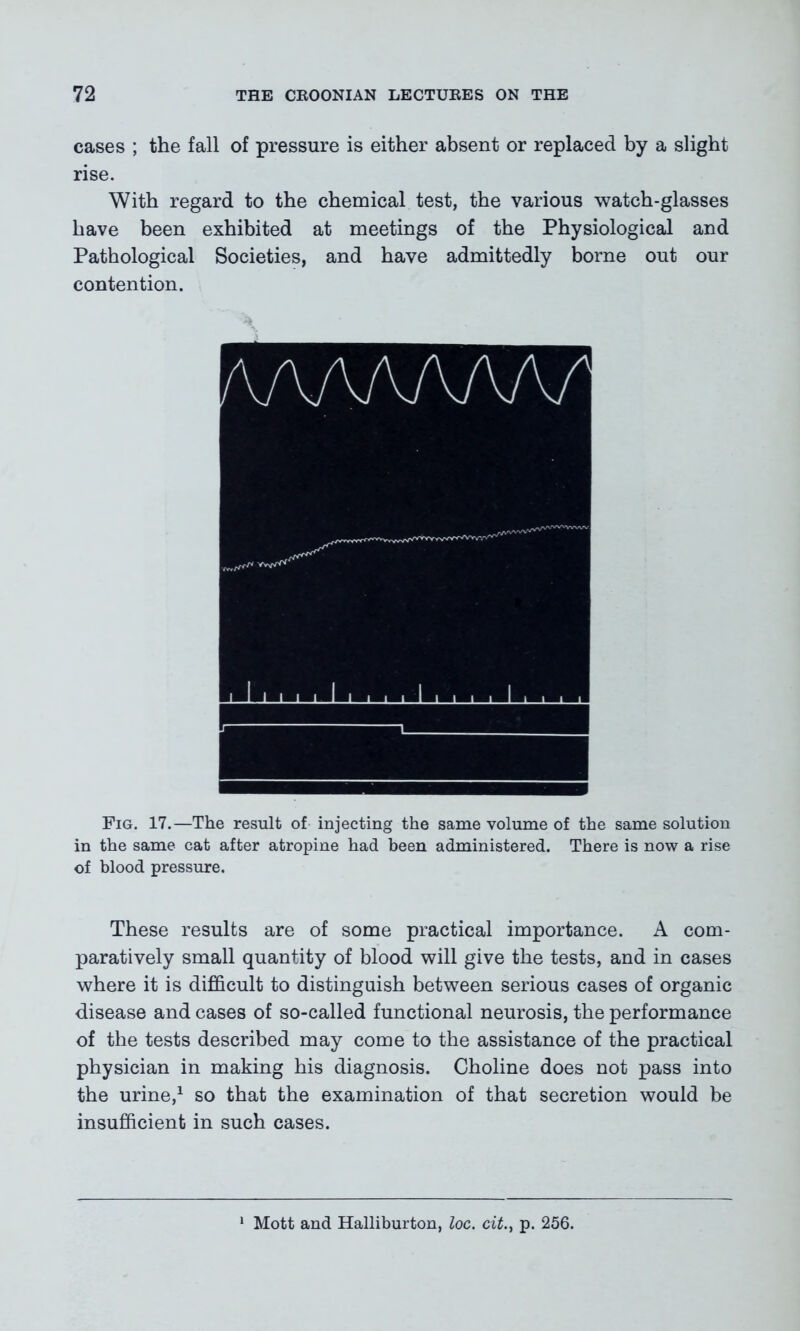 cases ; the fall of pressure is either absent or replaced by a slight rise. With regard to the chemical test, the various watch-glasses have been exhibited at meetings of the Physiological and Pathological Societies, and have admittedly borne out our contention. Fig. 17.—The result of injecting the same volume of the same solution in the same cat after atropine had been administered. There is now a rise of blood pressure. These results are of some practical importance. A com- paratively small quantity of blood will give the tests, and in cases where it is difficult to distinguish between serious cases of organic disease and cases of so-called functional neurosis, the performance of the tests described may come to the assistance of the practical physician in making his diagnosis. Choline does not pass into the urine,1 so that the examination of that secretion would be insufficient in such cases. Mott and Halliburton, loc. cit.} p. 256.