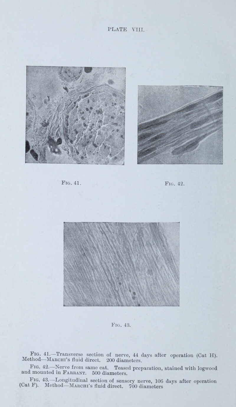 Fig. 41. Fig. 42. Fig. 43. Fig. 41. Transverse section of nerve, 44 days after operation (Cat H). Method—Marchi’s fluid direct. 200 diameters. Fig. 42. Nerve from same cat. Teased preparation, stained with logwood and mounted in Farrant. 500 diameters. Fig. 43. Longitudinal section of sensory nerve, 106 days after operation (Cat F). Method—Marchi’s fluid direct. 700 diameters