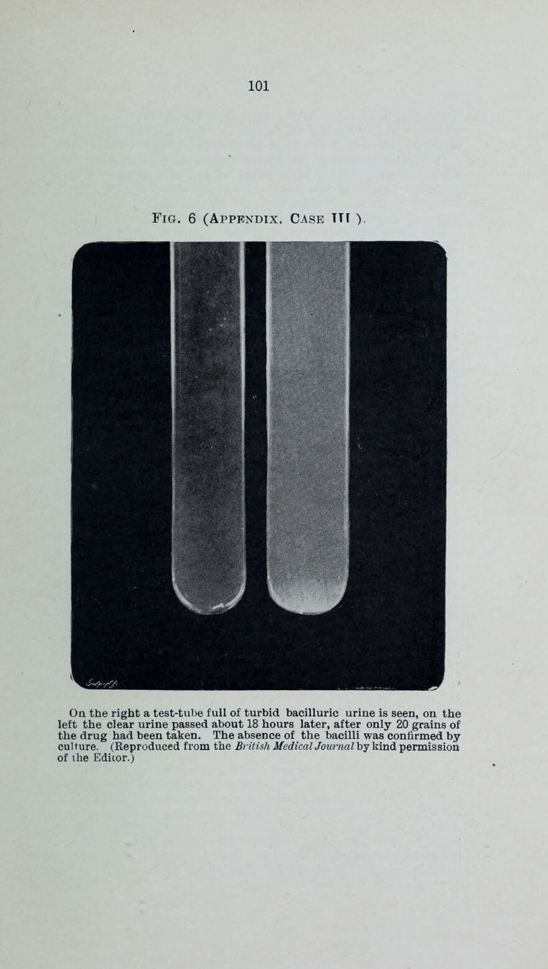 Fig. 6 (Appendix, Case TTI ). On the right a test-tube full of turbid bacilluric urine is seen, on the left the clear urine passed about 18 hours later, after only 20 grains of the drug had been taken. The absence of the bacilli was confirmed by culture. (Reproduced from the British Medical Journal by kind permission