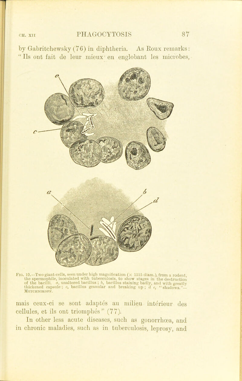 by Gabritchewsky (76) in diphtheria. As Eoux remarks: “Ils ont fait de leur mieux1 en englobant les microbes, mais ceux-ci se sont adapt es au milieu interieur des cellules, et ils ont triomphes” (77). In other less acute diseases, such as gonorrhoea, and in chronic maladies, such as in tuberculosis, leprosy, and Fig. 10.—Two giant-cells, seen under high magnification (x 1515 diam.), from a rodent, the spermophile, inoculated with tuberculosis, to show stages in the destruction of the bacilli, a, unaltered bacillus ; 6, bacillus staining badly, and with greatly thickened capsule; c, bacillus granular and breaking up; d e, “shadows.”— Metchnikofk.