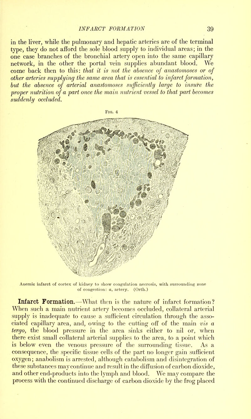 in the liver, while the pulmonary and hepatic arteries are of the terminal type, they do not afford the sole blood supply to individual areas; in the one case branches of the bronchial artery open into the same capillary network, in the other the portal vein supplies abundant blood. We come back then to this: that it is not the absence of anastomoses or of other arteries supplying the same area that is essential to infarct formation, but the absence of arterial anastomoses sufficiently large to insure the proper nutrition of a part once the main nutrient vessel to that part becomes suddenly occluded. Fig. 4 Anemic infarct of cortex of kidney to show coagulation necrosis, with surrounding zone of congestion: a, artery. (Orth.) Infarct Formation.—What then is the nature of infarct formation? When such a main nutrient artery becomes occluded, collateral arterial supply is inadequate to cause a sufficient circulation through the asso- ciated capillary area, and, owing to the cutting off of the main vis a tergo, the blood pressure in the area sinks either to nil or, when there exist small collateral arterial supplies to the area, to a point which is below even the venous pressure of the surrounding tissue. As a consequence, the specific tissue cells of the part no longer gain sufficient oxygen; anabolism is arrested, although catabolism and disintegration of these substances may continue and result in the diffusion of carbon dioxide, and other end-products into the lymph and blood. We may compare the process with the continued discharge of carbon dioxide by the frog placed