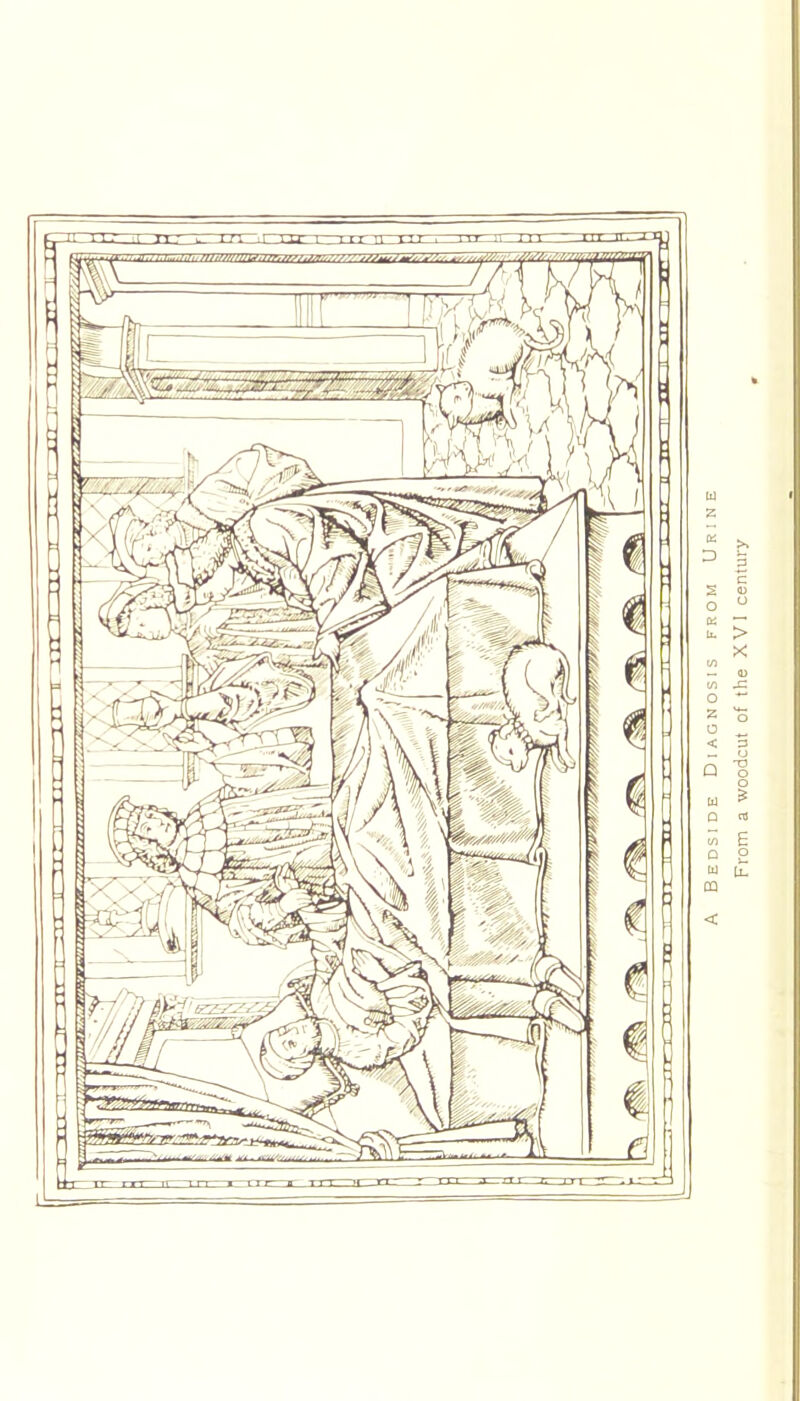 Bedside Diagnosis from Urine From a woodcut of the XVI century