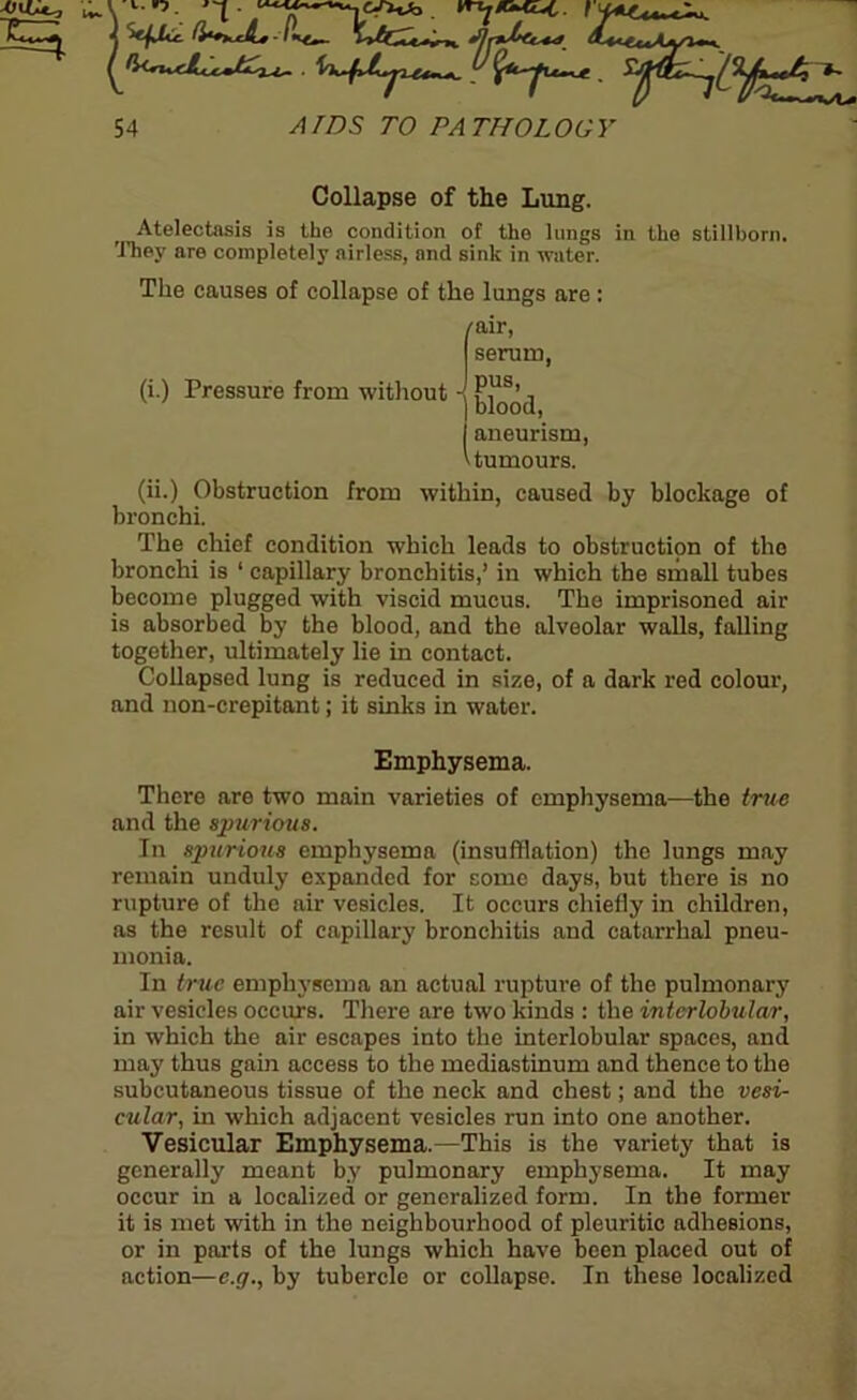 Collapse of the Lung. Atelectasis is the condition of the lungs in the stillborn. They are completely airless, and sink in water. The causes of collapse of the lungs are : (i.) Pressure from without /air, serum, j pus, ) blood, aneurism, Humours. (ii.) Obstruction from within, caused by blockage of bronchi. The chief condition which leads to obstruction of the bronchi is 1 capillary bronchitis,’ in which the small tubes become plugged with viscid mucus. The imprisoned air is absorbed by the blood, and the alveolar walls, falling together, ultimately lie in contact. Collapsed lung is reduced in size, of a dark red colour, and non-crepitant; it sinks in water. Emphysema. There are two main varieties of emphysema—the true and the spurious. In spurious emphysema (insufflation) the lungs may remain unduly expanded for some days, but there is no rupture of the air vesicles. It occurs chiefly in children, as the result of capillary bronchitis and catarrhal pneu- monia. In true emphysema an actual rupture of the pulmonary air vesicles occurs. There are two kinds : the interlobular, in which the air escapes into the interlobular spaces, and may thus gain access to the mediastinum and thence to the subcutaneous tissue of the neck and chest; and the vesi- cular, in which adjacent vesicles run into one another. Vesicular Emphysema.—This is the variety that is generally meant by pulmonary emphysema. It may occur in a localized or generalized form. In the former it is met with in the neighbourhood of pleuritic adhesions, or in parts of the lungs which have been placed out of action—e.g., by tubercle or collapse. In these localized