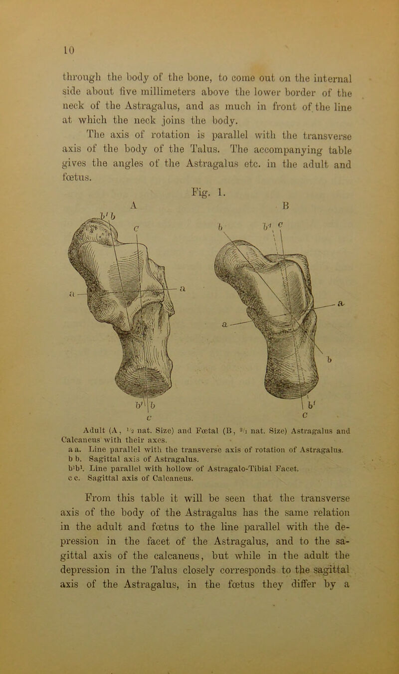 through the body of the bone, to come out on the internal side about live millimeters above the lower border of the neck of the Astragalus, and as much in front of the line at which the neck joins the body. The axis of rotation is parallel with the transverse axis of the body of the Talus. The accompanying table gives the angles of the Astragalus etc. in the adult and foetus. Fig. 1. A B Adult (A, ‘a nat. Size) and Foetal (B, nat. Size) Astragalus and Calcaneus with their axes. a a. Line parallel with the transverse axis of rotation of Astragalus, b b. Sagittal axis of Astragalus. b'b1. Line parallel with hollow of Astragalo-Tibial Facet, c c. Sagittal axis of Calcaneus. From this table it will be seen that the transverse axis of the body of the Astragalus has the same relation in the adult and foetus to the line parallel with the de- pression in the facet of the Astragalus, and to the sa- gittal axis of the calcaneus, but while in the adult the depression in the Talus closely corresponds to the sagittal axis of the Astragalus, in the foetus they differ by a