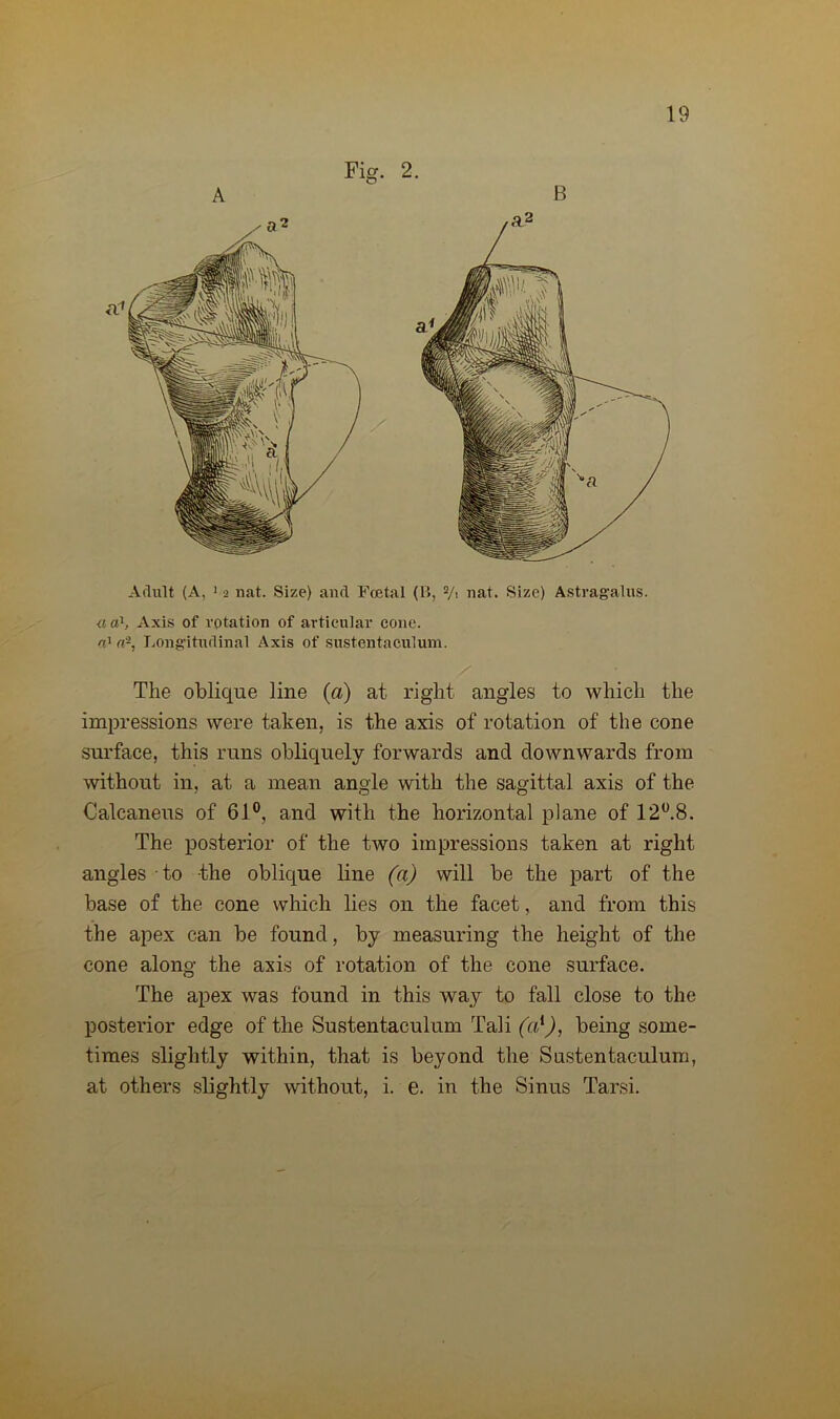 Fig. 2. Adult (A, > 2 nat. Size) and Foetal (B, 2/i nat. Size) Astragalus. a o', Axis of rotation of articular cone. rO ci'2, Longitudinal Axis of sustentaculum. The oblique line (a) at right angles to which the impressions were taken, is the axis of rotation of the cone surface, this runs obliquely forwards and downwards from without in, at a mean angle with the sagittal axis of the Calcaneus of 61°, and with the horizontal plane of 12°.8. The posterior of the two impressions taken at right angles to the oblique line (a) will be the part of the base of the cone which lies on the facet, and from this the apex can be found, by measuring the height of the cone along the axis of rotation of the cone surface. The apex was found in this way to fall close to the posterior edge of the Sustentaculum Tali (a1), being some- times slightly within, that is beyond the Sustentaculum, at others slightly without, i. e. in the Sinus Tarsi.