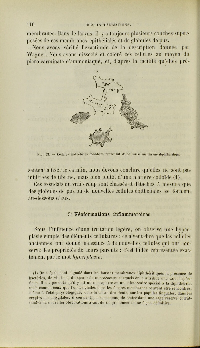 membranes. Dans le larynx il y a Lonjours plusieurs couches super- posées de ces membranes épilbéliales et de globules de pus. Nous avons vérifié rexactitude de la description donnée par Wagner. Nous avons dissocié et coloré ces cellules au moyen du l)icro-carminate d’ammoniaque, et, d’après la facilité qu’elles pré- Fig. 53. — Cellules épilliéliales moLliliées provenant d'une fausse membrane diphlhérilicjue. sentent à fixer le carmin, nous devons conclure qu’elles ne sont pas infiltrées de fibrine, mais bien plutôt d’une matière colloïde (1). Ces exsudats du vrai croup sont chassés et détachés à mesure que des globules de pus ou de nouvelles cellules épithéliales se forment au-dessous d’eux. 3 Néoformations inflammatoires. Sous l’influence d’une irritation légère, on observe une hyper- plasie simple des éléments cellulaires : cela veut dire que les cellules anciennes ont donné naissance à de nouvelles cellules qui ont con- servé les propriétés de leurs parents : c’est l’idée représentée exac- tement par le mot hyperplasie. (1) On a également signalé dans les fausses membranes diplitliéritiques la présence de bactéries, de vibrions, de spores de microcoeens auxquels on a atlribué une valeur spéci- fique. Il est possible qu’il y ait un micropbyte ou un microzoaire spécial à la dipblbérite, mais comme ceux que l’on a signalés dans les fausses membranes peuvent être rencontrés, même à l’état physiologique, dans le tartre des dents, sur les iiapilles linguales, dans les cryiitcs des amygdales, il convient, pensons-nous, de rester dans une sage réserve et d’at- tendre de nouvelles observations avant de se prononcer d’une fa(;ou définitive.