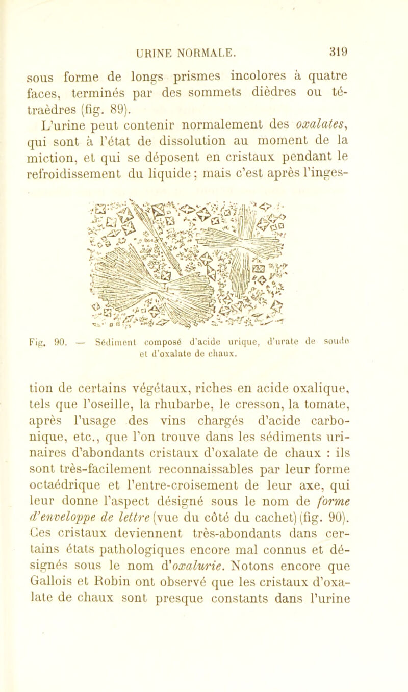 sous forme de longs prismes incolores à quatre faces, terminés par des sommets dièdres ou té- traèdres (fig. 89). L’urine peut contenir normalement des oxalates, qui sont à l’état de dissolution au moment de la miction, et qui se déposent en cristaux pendant le refroidissement du liquide; mais c’est après l’inges- Fig. 90. — Sédiment composé d'acide urique, d'urate de soude et d'oxalate de chaux. tion de certains végétaux, riches en acide oxalique, tels que l’oseille, la rhubarbe, le cresson, la tomate, après l’usage des vins chargés d’acide carbo- nique, etc., que l’on trouve dans les sédiments uri- naires d’abondants cristaux d’oxalate de chaux : ils sont très-facilement reconnaissables par leur forme octaédrique et l’entre-croisement de leur axe, qui leur donne l’aspect désigné sous le nom de forme d'enveloppe de lettre (vue du côté du cachet) (fig. 90). Les cristaux deviennent très-abondants dans cer- tains états pathologiques encore mal connus et dé- signés sous le nom d'oxalurie. Notons encore que Gallois et Robin ont observé que les cristaux d’oxa- late de chaux sont presque constants dans l’urine