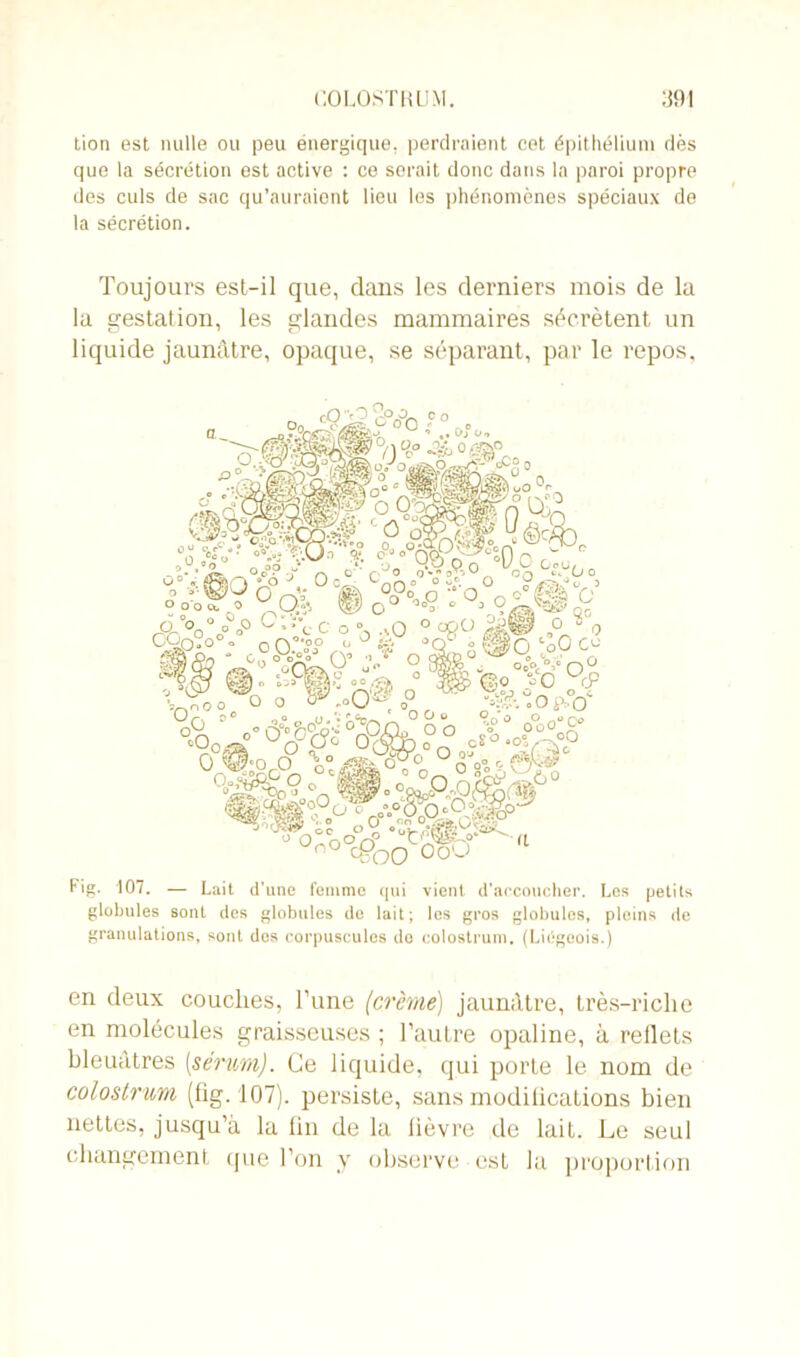 tion est nulle ou peu énergique, perdraient cet épithélium dès que la sécrétion est active : ce serait donc dans la paroi propre des culs de sac qu’auraient lieu les phénomènes spéciaux de la sécrétion. Toujours est-il que, dans les derniers mois de la la gestation, les glandes mammaires sécrètent un liquide jaunâtre, opaque, se séparant, par le repos, Fig. 107. — Lait d’une femmo qui vient d'accoucher. Les petits globules sont des globules de lait; les gros globules, pleins de granulations, sont des corpuscules do colostrum. (Liégeois.) en deux couches, l’une (crème) jaunâtre, très-riclie en molécules graisseuses ; l’autre opaline, à reflets bleuâtres [sérum). Ce liquide, qui porte le nom de colostrum (fig. 107). persiste, sans modifications bien nettes, jusqu’à la fin de la lièvre de lait. Le seul changement que l’on y observe est la proportion