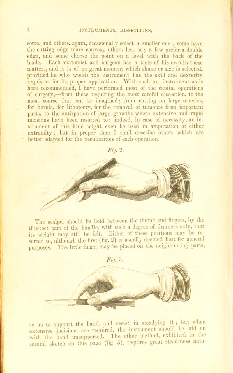 some, and others, again, occasionally select a smaller one ; some have the cutting edge more convex, others less so; a few prefer a double edge, and some choose the point on a level with the back of the blade. Each anatomist and surgeon has a taste of his own in these matters, and it is of no great moment which shape or size is selected, provided he who wields the instrument has the skill and dexterity requisite for its proper application. With such an instrument as is here recommended, I have performed most of the capital operations of surgery,—from those requiring the most careful dissection, to the most coarse that can be imagined; from cutting on large arteries, for hernia, for lithotomy, for the removal of tumours from important parts, to the extirpation of large growths where extensive and rapid incisions have been resorted to: indeed, in case of necessity, an in- strument of this kind might even be used in amputation of either extremity; but in proper time I shall describe others which are ' better adapted for the peculiarities of each operation. Fig. 2. The scalpel should be held between the thumb and fingers, by the thickest part of the handle, with such a degree of firmness only, that its weight may still be felt. Either of these positions may be re- sorted to, although the first (fig. 2) is usually deemed best for general purposes. The little finger may be placed on the neighbouring parts, Fig. 3. so as to support the hand, and assist in steadying it; but when extensive incisions are required, the instrument should be laid on with the hand unsupported. The other method, exhibited in the second sketch on this page (fig. 3), requires great steadiness natu-