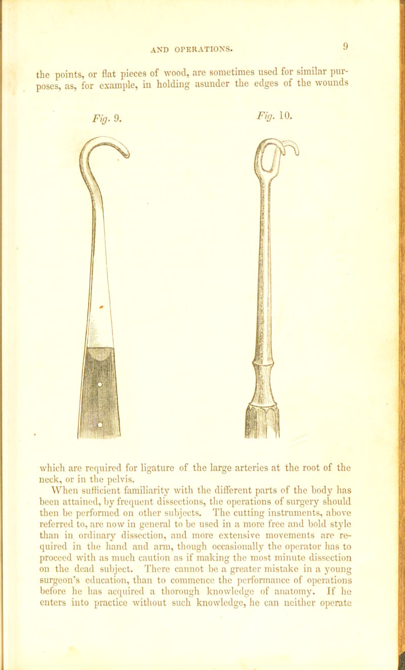 the points, or flat pieces of wood, are sometimes used for similar pur- poses, as, for example, in holding asunder the edges of the wounds Fig. 9. Fig. 10. which are required for ligature of the large arteries at the root of the neck, or in the pelvis. When sufficient familiarity with the different parts of the body has been attained, by frequent dissections, the operations of surgery should then be performed on other subjects. The cutting instruments, above referred to, are now in general to be used in a more free and bold style than in ordinary dissection, and more extensive movements are re- quired in the hand and arm, though occasionally the operator has to proceed with as much caution as if making the most minute dissection on the dead subject. There cannot be a greater mistake in a young surgeon’s education, than to commence the performance of operations before he has acquired a thorough knowledge of anatomy. If he enters into practice without such knowledge, he can neither operate