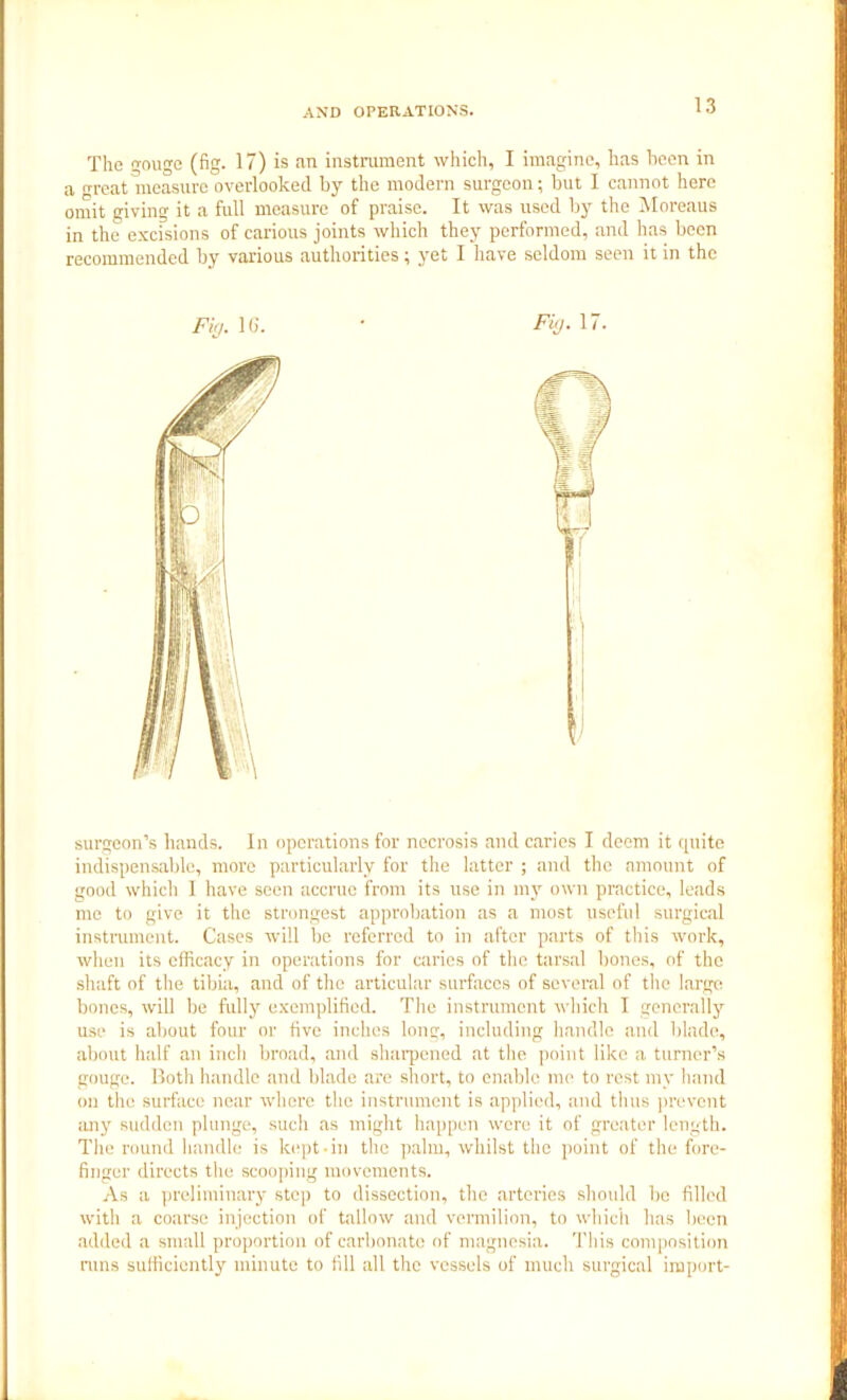 The gouge (fig. 17) is an instrument which, I imagine, has been in a great measure overlooked by the modern surgeon; but I cannot here omit giving it a full measure of praise. It was used by the Moreaus in the excisions of carious joints which they performed, and has been recommended by various authorities; yet I have seldom seen it in the surgeon’s hands. In operations for necrosis and caries I deem it quite indispensable, more particularly for the latter ; and the amount of good which 1 have seen accrue from its use in my own practice, leads me to give it the strongest approbation as a most useful surgical instrument. Cases will be referred to in after parts of this work, when its efficacy in operations for caries of the tarsal bones, of the shaft of the tibia, and of the articular surfaces of several of the large; bones, will be fully exemplified. The instrument which I generally use is about four or five inches long, including handle and blade, about half an inch broad, and sharpened at the point like a turner’s gouge. Both handle and blade are short, to enable me to rest my hand on the surface near where the instrument is applied, and thus prevent any sudden plunge, such as might happen were it of greater length. The round handle is kept-in the palm, whilst the point of the fore- finger directs the scooping movements. As a preliminary step to dissection, the arteries should be filled with a coarse injection of tallow and vermilion, to which has been added a small proportion of carbonate of magnesia. This composition runs sufficiently minute to fill all the vessels of much surgical iruport-