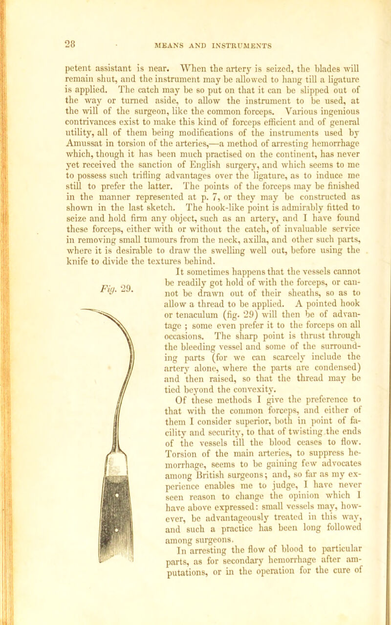 petent assistant is near. When the artery is seized, the blades will remain shut, and the instrument may be allowed to hang till a ligature is applied. The catch may be so put on that it can be slipped out of the way or turned aside, to allow the instrument to be used, at the will of the surgeon, like the common forceps. Various ingenious contrivances exist to make this kind of forceps efficient and of general utility, all of them being modifications of the instruments used by Amussat in torsion of the arteries,—a method of arresting hemorrhage which, though it has been much practised on the continent, has never yet received the sanction of English surgery, and which seems to me to possess such trifling advantages over the ligature, as to induce me still to prefer the latter. The points of the forceps may be finished in the manner represented at p. 7, or they may be constructed as shown in the last sketch. The hook-like point is admirably fitted to seize and hold firm any object, such as an artery, and I have found these forceps, either with or without the catch, of invaluable service in removing small tumours from the neck, axilla, and other such parts, where it is desirable to draw the swelling well out, before using the knife to divide the textures behind. It sometimes happens that the vessels cannot be readily got hold of with the forceps, or can- not be drawn out of their sheaths, so as to allow a thread to be applied. A pointed hook or tenaculum (fig. 29) will then be of advan- tage ; some even prefer it to the forceps on all occasions. The sharp point is thrust through the bleeding vessel and some of the surround- ing parts (for we can scarcely include the artery alone, where the parts are condensed) and then raised, so that the thread may be tied beyond the convexity. Of these methods I give the preference to that with the common forceps, and either of them I consider superior, both in point of fa- cility and security, to that of twisting the ends of the vessels till the blood ceases to flow. Torsion of the main arteries, to suppress he- morrhage, seems to be gaining few advocates among British surgeons; and, so far as my ex- perience enables me to judge, I have never seen reason to change the opinion which 1 have above expressed: small vessels may, how- ever, be advantageously treated in this way, and such a practice has been long followed among surgeons. In arresting the flow of blood to particular parts, as for secondary hemorrhage after am- putations, or in the operation for the cure of