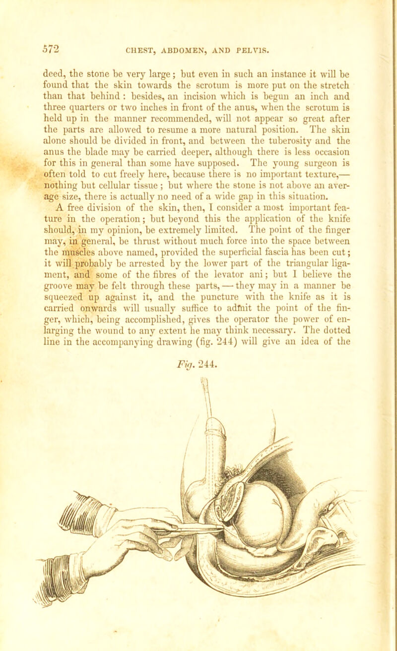 deed, the stone be very large; but even in such an instance it will be found that the skin towards the scrotum is more put on the stretch than that behind : besides, an incision which is begun an inch and three quarters or two inches in front of the anus, when the scrotum is held up in the manner recommended, will not appear so great after the parts are allowed to resume a more natural position. The skin alone should be divided in front, and between the tuberosity and the anus the blade may be carried deeper, although there is less occasion for this in general than some have supposed. The young surgeon is often told to cut freely here, because there is no important texture,— nothing but cellular tissue; but where the stone is not above an aver- age size, there is actually no need of a wide gap in this situation. A free division of the skin, then, I consider a most important fea- ture in the operation; but beyond this the application of the knife should, in my opinion, be extremely limited. The point of the finger may, in general, be thrust without much force into the space between the muscles above named, provided the superficial fascia has been cut; it will.probably be arrested by the lower part of the triangular liga- ment, and some of the fibres of the levator ani; but I believe the groove may be felt through these parts, — they may in a manner be squeezed up against it, and the puncture with the knife as it is earned onwards will usually suffice to admit the point of the fin- ger, which, being accomplished, gives the operator the power of en- larging the wound to any extent he may think necessary. The dotted line in the accompanying drawing (fig. 244) will give an idea of the