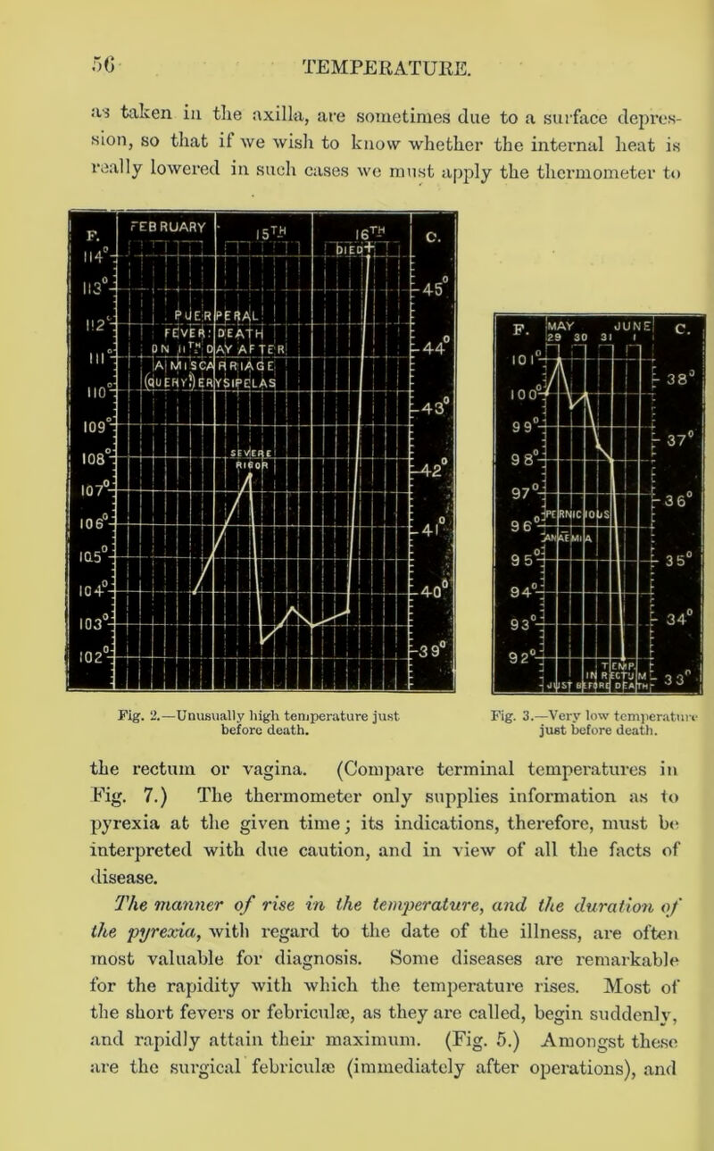 as taken in the axilla, are sometimes due to a surface depx'es- sion, so that it we wish to know whether the internal heat is really lowered in such cases we must apply the thermometer to Fig. 2.—Unusually liigh temperature just before death. Fig. 3.—Very low temperature just before death. the rectum or vagina. (Compare terminal temperatures in Fig. 7.) The thermometer only supplies information as to pyrexia at the given time; its indications, therefore, must be interpreted with due caution, and in view of all the facts of <lisease. The manner of rise in the temperature, and the duratio7i of the pyrexia, with regard to the date of the illness, are often most valuable for diagnosis. Some diseases are remarkable for the rapidity with which the temjxerature rises. Most of the short fevers or febriculfe, as they are called, begin suddenly, and rapidly attain their maximum. (Fig. 5.) Amongst these are the surgical febriculm (immediately after operations), and