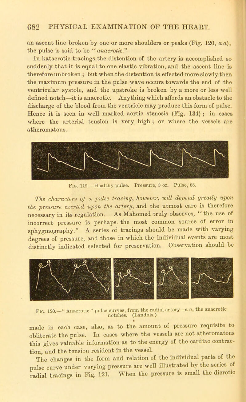 an ascent line broken by one or more shoulders or peaks (Fig. 120, a a), the pulse is said to be “ anacrotic.” In katacrotic tracings the distention of the artery is accomplished so suddenly that it is equal to one elastic vibration, and the ascent line is therefore unbroken ; but when the distention is effected more slowly then the maximum pressure in the pulse wave occurs towards the end of the ventricular systole, and the upstroke is broken by a more or less well defined notch—it is anacrotic. Anything which affords an obstacle to the discharge of the blood from the ventricle may produce this form of pulse. Hence it is seen in well marked aortic stenosis (Fig. 134) ; in cases where the arterial tension is very high ; or where the vessels are atheromatous. Fio. 119.—Healthy pulse. Pressure, 3 oz. Pulse, 68. The characters oj a pulse tracing, however, will depend greatly upon the pressure exerted upon the artery, and the utmost care is therefore necessary in its regulation. As Mahomed truly observes, “ the use of incorrect pressure is perhaps, the most common source of error in sphygmography.” A series of tracings should be made with varying degrees of pressure, and those in which the individual events are most distinctly indicated selected for preservation. Observation should be Fig. 120.—11 Anacrotic ” pulse curves, from the radial artery—a a, the anacrotic notches. (Landois.) » made in each case, also, as to the amount of pressure requisite to obliterate the pulse. In cases where the vessels are not atheromatous this gives valuable information as to the energy of the cardiac contrac- tion, and the tension resident in the vessel. The changes in the form and relation of the individual parts of the pulse curve under varying pressure are well illustrated by the series of