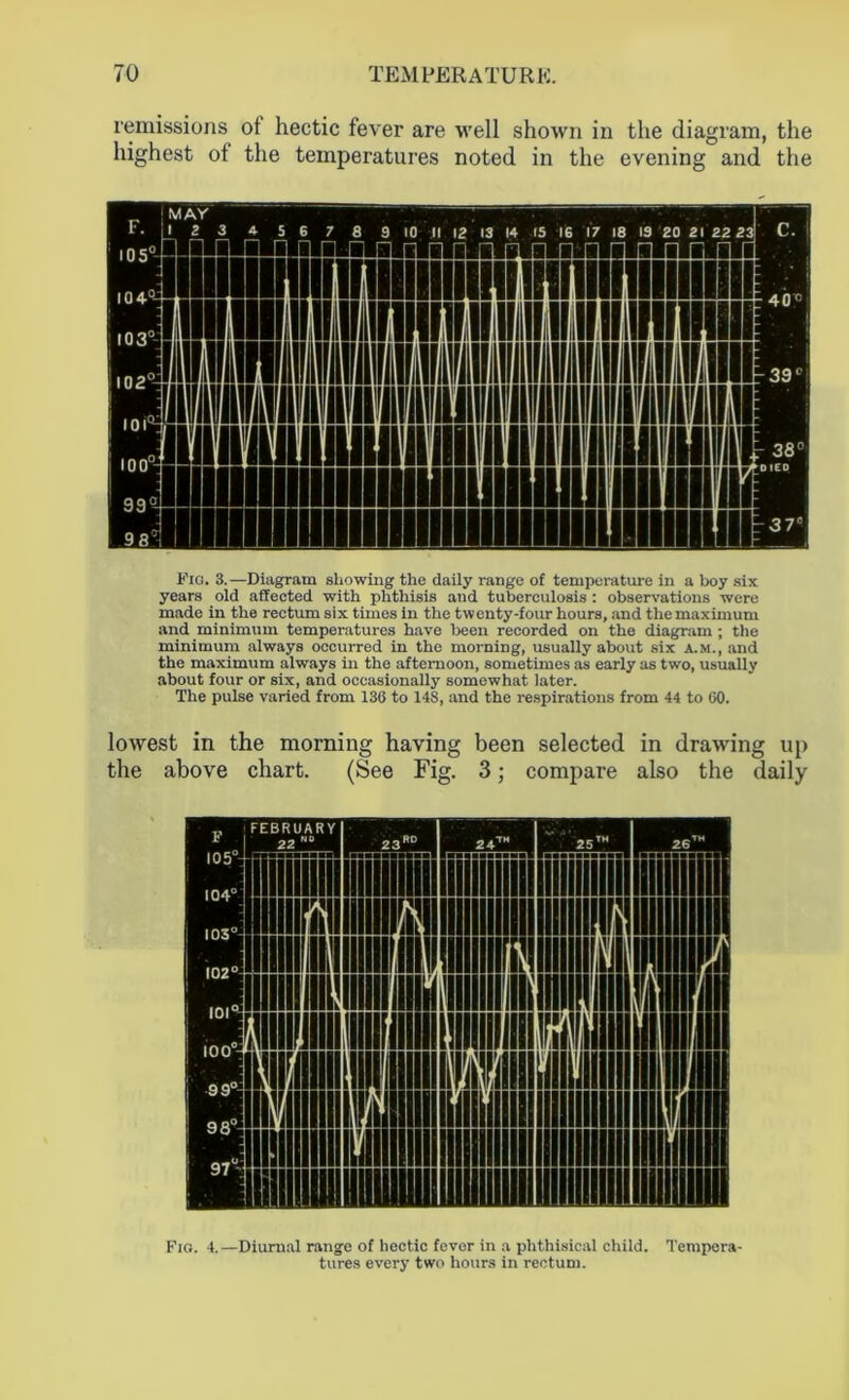 remissions of hectic fever are well shown in the diagram, the highest of the temperatures noted in the evening and the Fig. 3.—Diagram showing the daily range of temperature in a boy six years old affected with phthisis and tuberculosis : observations were made in the rectum six times in the twenty-four hours, and the maximum and minimum temperatures have been recorded on the diagram ; the minimum always occurred in the morning, usually about six a.m., and the maximum always in the afternoon, sometimes as early as two, usually about four or six, and occasionally somowhat later. The pulse varied from 136 to 148, and the respirations from 44 to 60. lowest in the morning having been selected in drawing up the above chart. (See Fig. 3; compare also the daily Fig. 4.—Diurnal range of hectic fever in a phthisical child. Tempera- tures every two hours in rectum.