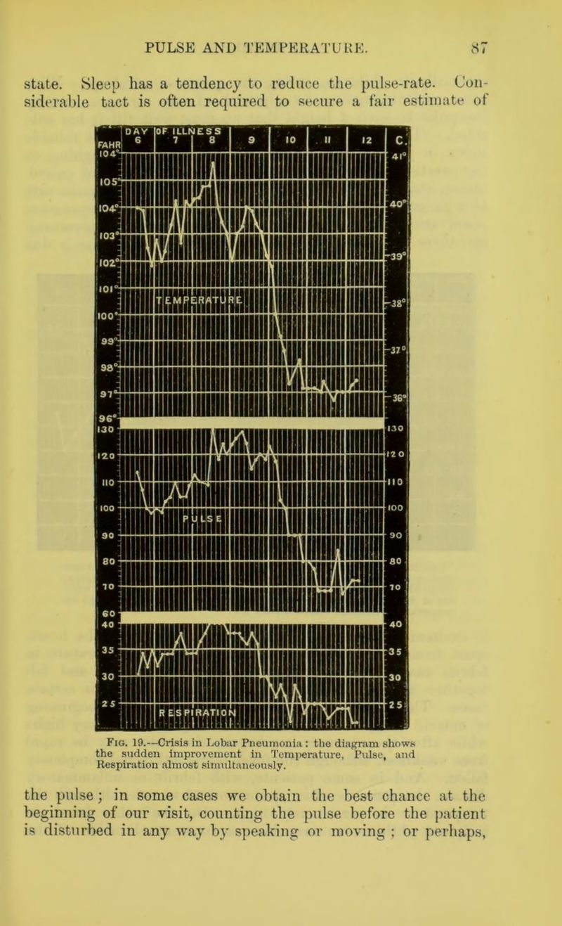 PULSE AND TEMPERATURE. S i state. Sleep has a tendency to reduce the pulse-rate. Con- siderable tact is often required to secure a fair estimate of Fig. 19.—Crisis in Lobar Pneumonia : tho diagram shows the sudden improvement in Temperature, Pulse, and Respiration almost simultaneously. the pulse; in some cases we obtain the best chance at the beginning of our visit, counting the pulse before the patient is disturbed in any way by speaking or moving ; or perhaps,