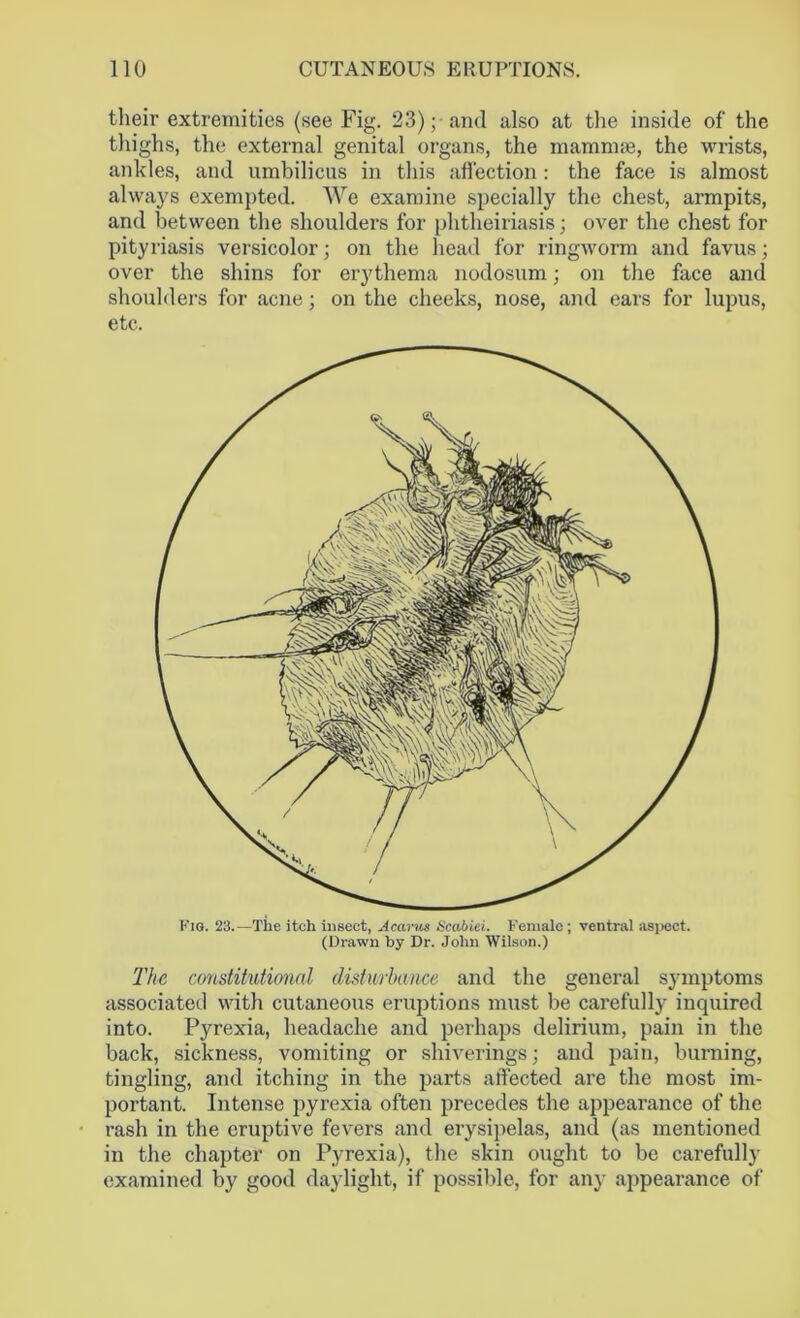 their extremities (see Fig. 23); and also at the inside of the thighs, the external genital organs, the mammae, the wrists, ankles, and umbilicus in this affection : the face is almost always exempted. We examine specially the chest, armpits, and between the shouldei’s for phtheiriasis; over the chest for pityriasis versicolor; on the head for ringworm and favus; over the shins for erythema nodosum; on the face and shoulders for acne; on the cheeks, nose, and ears for lupus, etc. Kig. 23.—The itch insect, Acarus Scabiei. Female; ventral aspect. (Drawn by Dr. John Wilson.) The constitutional disturbance and the general symptoms associated with cutaneous eruptions must be carefully inquired into. Pyrexia, headache and perhaps delirium, pain in the back, sickness, vomiting or shiverings; and pain, burning, tingling, and itching in the parts affected are the most im- portant. Intense pyrexia often precedes the appearance of the rash in the eruptive fevers and erysipelas, and (as mentioned in the chapter on Pyrexia), the skin ought to be carefully examined by good daylight, if possible, for any appearance of