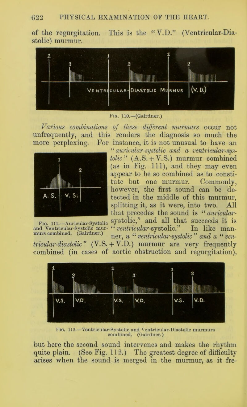 of the regurgitation. This is the “ V.D.” (Ventricular-Dia- stolic) murmur. Fig. 110.—(Gairdner.) Various combinations of these different murmurs occur not unfrequently, and this renders the diagnosis so much the more perplexing. For instance, it is not unusual to have an “ auricular-systolic and a ventricular-sys- tolic” (A.S.+ V.S.) murmur combined (as in Fig. Ill), and they may even appear to be so combined as to consti- tute but one murmur. Commonly, however, the first sound can be de- tected in the middle of this murmur, splitting it, as it were, into two. All that precedes the sound is “ auricidar- F,o. in.—Auriouiar-Systoiic systolic,” and all that succeeds it is “ventricular-systolic.” In like man- ner, a “ ventricular-systolic ” and a “ven- tricular-diastolic” (V.S. + V.D.) murmur are very frequently combined (in cases of aortic obstruction and regurgitation), and Ventricular-Systolic mur murs combined. (Gairdner.) Fig. 112.—Ventricular-Systolic and Ventricular-Diastolic murmurs combined. (Gairdner.) but here the second sound intervenes and makes the rhythm quite plain. (See Fig. 112.) The greatest degree of difficulty arises when the sound is merged in the murmur, as it fre-