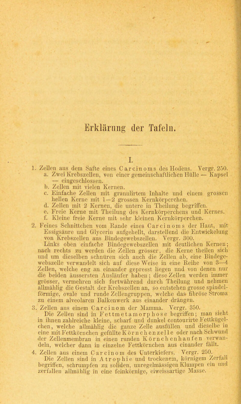 Erklärung der Tafeln. I. 1. Zellen aus dem Safte eines Carcinoms des Hodens. Vergr. 250. a. Zwei Krebszellen, von einer gemeinschaftlichen Hülle — Kapsel — eingeschlossen. 1). Zellen mit vielen Kernen. c. Einfache Zellen mit granulirtem Inhalte und einem grossen hellen Kerne mit 1—2 grossen Kernkörperchen. d. Zellen mit 2 Kernen, die untere in Theilung begriffen. e. Freie Kerne mit Theilung des Kernkörperchens und Kernes. f. Kleine freie Kerne mit sehr kleinen Kernkörperchen. 2. Feines Schnittchen vom Rande eines Carcinoms der Haut, mit Essigsäure und Glycerin aufgehellt, darstellend die Entwickelung von Krebszellen aus Bindegewebszellen. Vergr. 300. Links oben einfache Bindegewebszellen mit deutlichen Kernen; nach rechts zu werden die Zellen grösser, die Kerne theilen sich und um dieselben schnüren sich auch die Zellen ab, eine Biudege- webszelle verwandelt sich auf diese Weise in eine Reihe von 3—4 Zellen, welche eng an einander gepresst liegen und von denen nur die beiden äussersten Ausläufer haben; diese Zellen werden immer gi’össer, vermehren sich fortwährend durch Theilung und nehmen allmählig die Gestalt der Krebszellen an, so entstehen grosse spindel- förmige, ovale und runde Zelleugruppen, welche das fibröse Stroma zu einem alveolaren Balkenwerk aus einander drängen. 3. Zellen aus einem Car einem der Mamma. Vergr. 350. Die Zellen sind in Fettmetamorphose begriffen; man sieht in ihnen zahlreiche kleine, scharf und dunkel coutourirte Fettkügel- chen, welche allmählig die ganze Zelle ausfüllen und dieselbe in eine mit Fettkörnchen gefüllteKörnchenzelle oder nach Schwund der Zellenmembran in einen runden Köruch enhaufen verwan- deln, welcher dann in einzelne Fettköimchen aus einander fällt. 4. Zellen aus einem Carcinom des Unterkiefers. Vergr. 250. Die Zellen sind in Atrophie und trockenem, körnigem Zeriall begriffen, schrumpfen zu soliden, unregelmässigen Klumpen ein und zerfallen allmahlig in eine feinkörnige, eiweissartige Masse.