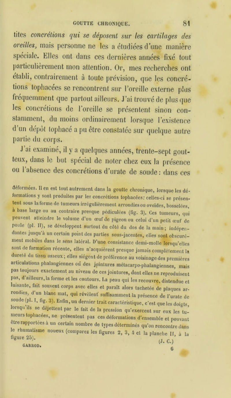 tites concrétions qui se déposent sur les cartilages des oreilles, mais personne ne les a étudiées d’une manière spéciale. Elles ont dans ces dernières années fixé tout particulièrement mon attention. Or, mes recherches ont établi, contrairement à toute prévision, que les concré- tions tophacees se rencontrent sur l’oreille externe plus fréquemment que partout ailleurs. J’ai trouvé de plus que les concrétions de l’oreille se présentent sinon con- stamment, du moins ordinairement lorsque l’existence d’un dépôt lophacé a pu être constatée sur quelque autre partie du corps. J’ai examiné, il y a quelques années, trente-sept gout- teux, dans le but spécial de noter chez eux la présence ou l’absence des concrétions d’urate de soude: dans ces déformées. lien est tout autrement dans la goutte chronique, lorsque les dé- formations y sont produites par les concrétions tophacées: celles-ci se présen- tent sous la forme de tumeurs irrégulièrement arrondies ou ovoïdes, bosselées, à base large ou au contraire presque pédiculées (fig. 3). Ces tumeurs, qui peuvent atteindre le volume d’un œuf de pigeon ou celui d’un petit œuf de poule (pl. 11), se développent surtout du côté du dos de la main; indépen- dantes jusqu à un certain point des parties sous-jacentes, elles sont obscuré- ment mobiles dans le sens latéral. D’une consistance demi-molle lorsqu’elles sont de formation récente, elles n’acquièrent presque jamais complètement la dureté du tissu osseux ; elles siègent de préférence au voisinage des premières articulations phalaugiennes oii des jpintures métacarpo-phalangiennes, mais pas toujours exactement au niveau de ces jointures, dont elles ne reproduisent pas, d’ailleurs,la forme et les contours. La peau qui les recouvre, distendue et luisante, fait souvent corps avec elles et paraît alors tachetée de plaques ar- rondis, d’un blanc mat, qui révèlent' suffisamment la présence de l’uratc de soude (pl. I, fig. 3). Enfin, un dernier trait caractéristique, c’est que les dofofo lorsqu ils se déjettent par le fait de la pression qu’exercent sur eux les tu- meurs tophacées, ne présentent pas ces déformations d’ensemble et pouvant être rapportées à un certain nombre de types déterminés qu’on rencontre dans le rhumatisme noueux (comparez les figures 2, 3, 4 et la planche II à la flgurc 25'* (J. C.) GARUOD. ' 6