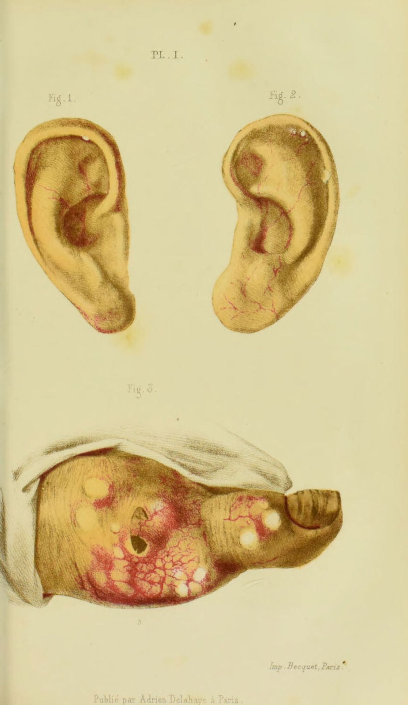 ri. ]. hnp Becyuet, Paris. Public par Adrien Delahay' :< Paris.