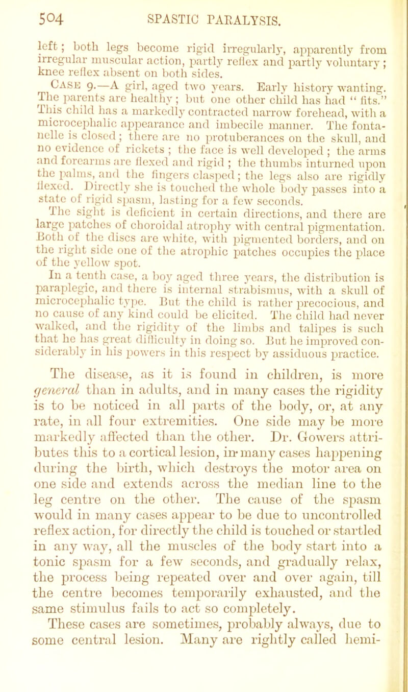 left; both legs become rigid irregularly, apparently from irregular muscular action, partly reflex and partly voluntarj'; knee reflex absent on both sides. Case 9.—A girl, aged two years. Early history wanting. The parents are healthy; but one other child has had “ fits.” This child has a markedly contracted narrow forehead, with a microcei)halic appearance and imbecile manner. The fonta- nelle is closed; there arc no iirotuberances on the skull, and no evidence of rickets ; the face is well developed ; the arms and forearms are flexed and rigid ; the thumbs inturned upon the palms, and the fingers clasped; the legs also are rigidly flexed. Directly she is touched the whole bod}' passes into a state of rigid spasm, lasting for a few seconds. The sight is deficient in certain directions, and there are large patches of choroidal atrojdiy with central pigmentation. Both of the discs are wliitc, with irigmcntcd borders, and on the right side one of the atrophic patches occupies the place of the yellow spot. In a tenth case, a boy aged three years, the distribution is Paraplegic, and there is internal .strabismus, with a skull of microcephalic tyj)e. But the child is rather precocious, and no cause of any kind could be elicited. The child had never walked, and the rigidity of the lindjs and talipes is such that he has great difliculty in doing so. But he improved con- siderably in his powers in this respect by assiduous practice. Tlie cli.sease, as it i.s found in children, is more general tlian in adults, and in many cases the rigidity is to be noticed in all parts of the body, or, at any rate, in all four extremities. One side may be more markedly aftected than tlie other. Dr. Gowers attri- butes this to a cortical lesion, in-many ca.ses happening during the Inrtli, which de.stroys the motor area on one side and extends across the median line to the leg centre on the other. The ciiuso of the spasm would in many cases appear to be due to unconti'olled reflex action, for directly the child is touched or startled in any way, all the muscles of the body start into a tonic sjyasm for a few seconds, and gradually relax, the process l)eing repeated over and over again, till the centi’e becomes temporaiily exhausted, and the same stimulus fails to act so completely. These cases are sometime.s, probably ahvaj's, due to some central lesion. Many are rightly called hemi-