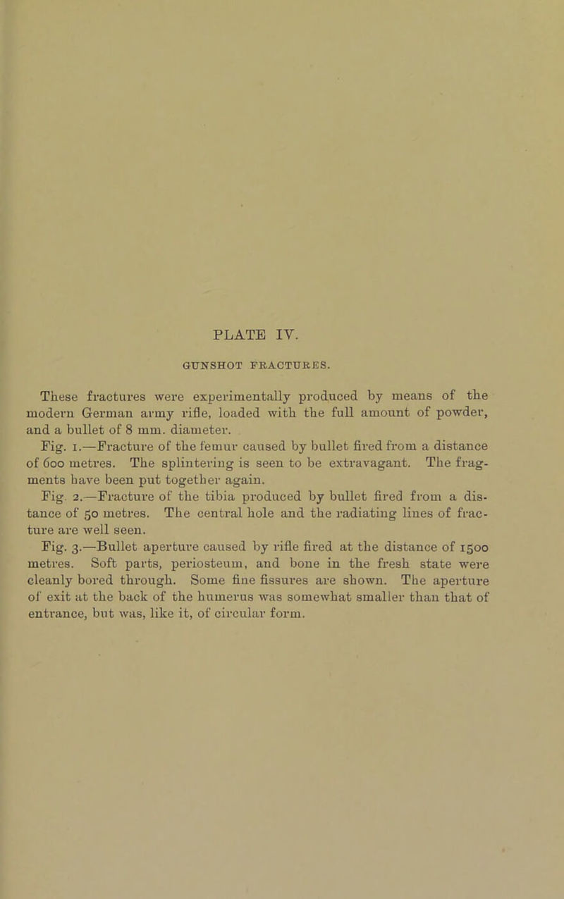 GUNSHOT FRACTURES. These fractures were experimentally produced by means of the modern German army rifle, loaded with the full amount of powder, and a bullet of 8 mm. diameter. Pig. i.—Fracture of the femur caused by bullet fired from a distance of 600 metres. The splintering is seen to be extravagant. The frag- ments have been put together again. Fig. 2.—Fracture of the tibia produced by bullet fired from a dis- tance of 50 metres. The central hole and the radiating lines of frac- ture are well seen. Fig. 3.—Bullet aperture caused by rifle fired at the distance of 1500 metres. Soft parts, periosteum, and bone in the fresh state were cleanly bored through. Some fine fissures are shown. The aperture of exit at the back of the humerus was somewhat smaller than that of entrance, but was, like it, of circular form.