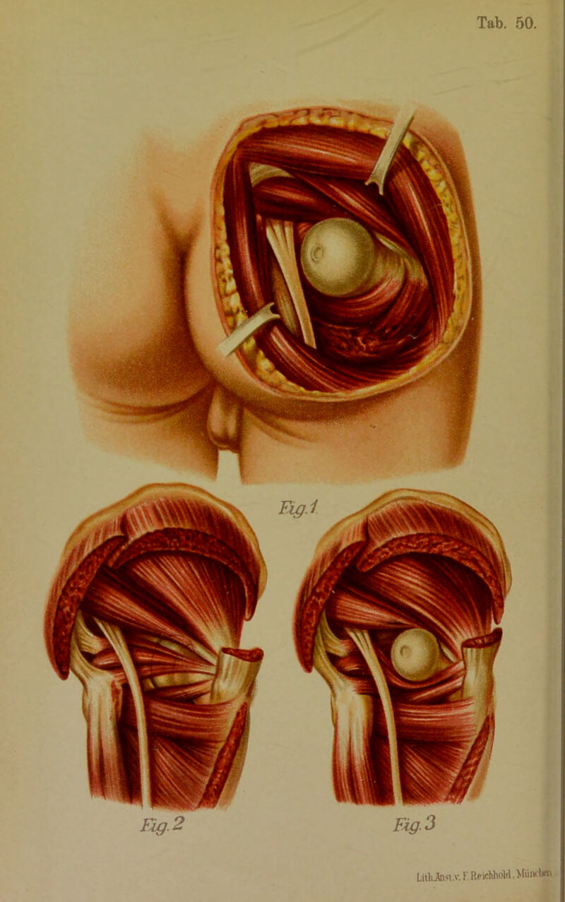 Fig. 2 Fig-3 LithJtasi.v*. K Reichholcl.
