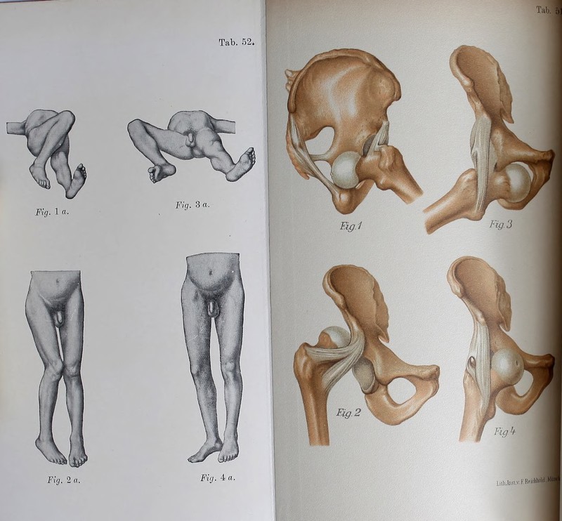 Fig. 1 a. Fig. 3 a. Fig. 2 a. Fig. 4 n.