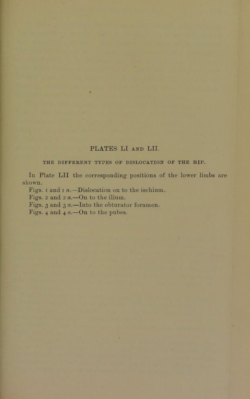 PLATES LI and LII. THE DIFFERENT TYPES OF DISLOCATION OF THE HIP. Ill Plate LII the corresponding positions of the lower limbs are shown. Figs, i and i a.—Dislocation on to the ischium. Figs. 2 and 2 a.—On to the ilium. Figs. 3 and 3 a.—Into the obturator foramen. Figs. 4 and 4 a.—On to the pubes.