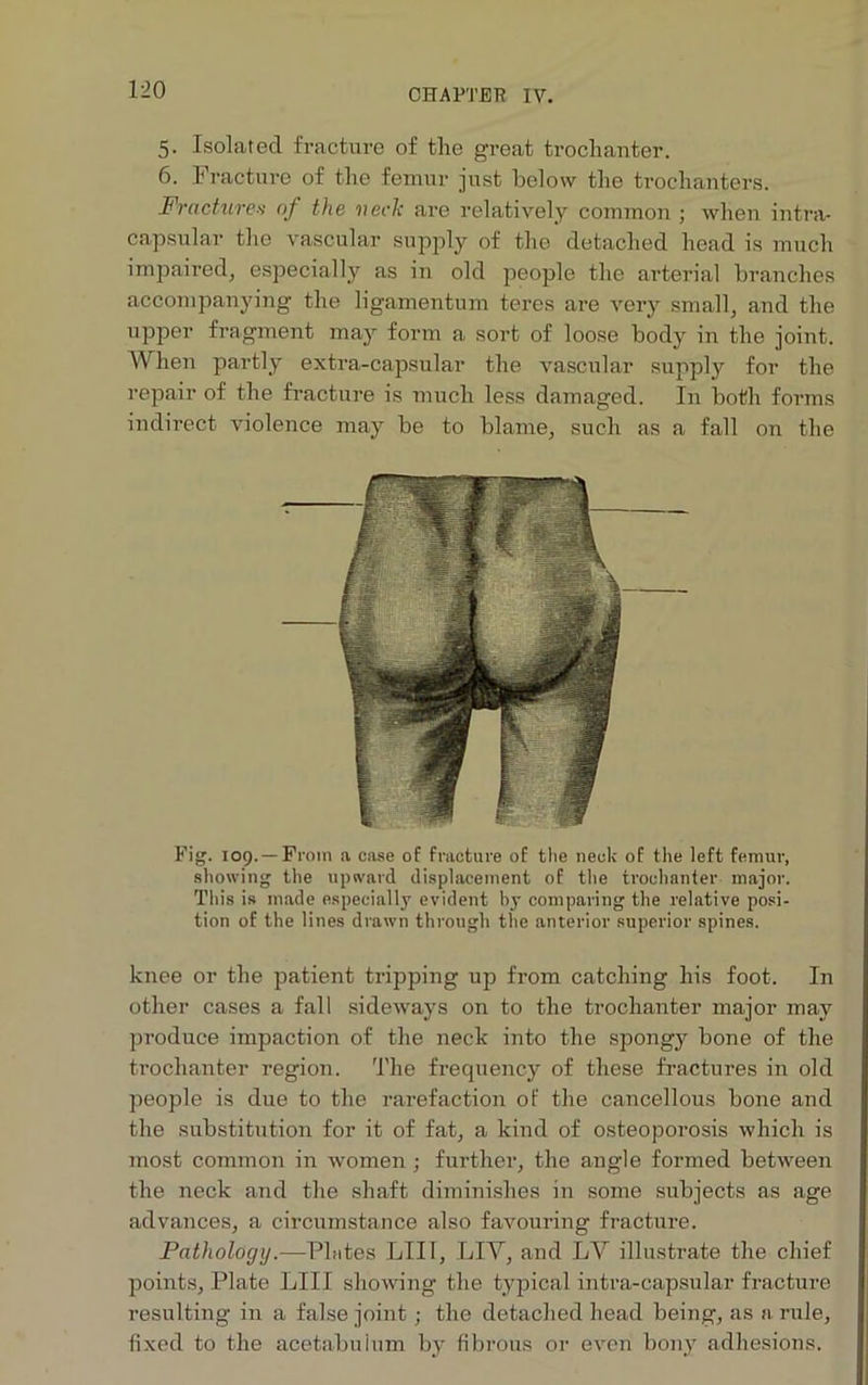 CHAPTER IV. 5. Isolated fracture of the great trochanter. 6. Fracture of the femur just below the trochanters. Fractures of the ueclc are relatively common ; when intra- cap sular the vascular supply of the detached head is much impaired, especially as in old people the arterial branches accompanying the ligamentum teres are very small, and the upper fragment may form a sort of loose body in the joint. When partly extra-capsular the vascular supply for the repair of the fracture is much less damaged. In both forms indirect violence may be to blame, such as a fall on the Fig. 109. —From a case of fracture of the neck of the left femur, showing the upward displacement of the trochanter major. This is made especially evident bj- comparing the relative posi- tion of the lines drawn through the anterior superior spines. knee or the patient tripping up from catching his foot. In other cases a fall sideways on to the trochanter major may produce impaction of the neck into the spongy bone of the trochanter region. The frequency of these fractures in old people is due to the rarefaction of the cancellous bone and the substitution for it of fat, a kind of osteoporosis which is most common in women ; further, the angle formed between the neck and the shaft diminishes in some subjects as age advances, a circumstance also favouring fracture. Pathology.—Plutes LIII, LIY, and LY illustrate the chief points, Plate LIII showing the typical intra-capsular fracture resulting in a false joint; the detached head being, as a rule, fixed to the acetabuium by fibrous or even bony adhesions.