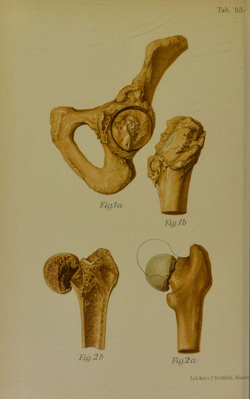 Lithina.v. F.Reichhold.Miinch j