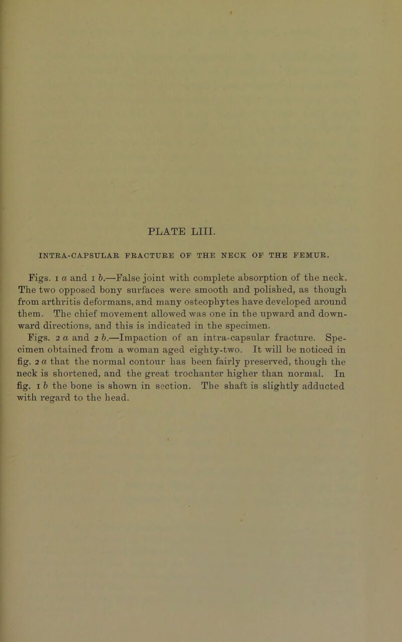 INTRA-CAPSULAR PRACTURE OP THE NECK OP THE PEMUE. Figs, i a and i b.—False joint with complete absorption of the neck. The two opposed bony surfaces were smooth and polished, as though from arthritis deformans, and many osteophytes have developed around them. The chief movement allowed was one in the upward and down- ward directions, and this is indicated in the specimen. Figs. 2 a and 2 b.—Impaction of an intra-capsular fracture. Spe- cimen obtained from a woman aged eighty-two. It will be noticed in fig. 2 a that the normal contour has been fairly preserved, though the neck is shortened, and the great trochanter higher than normal. In fig. 1 b the bone is shown in section. The shaft is slightly adducted with regard to the head.