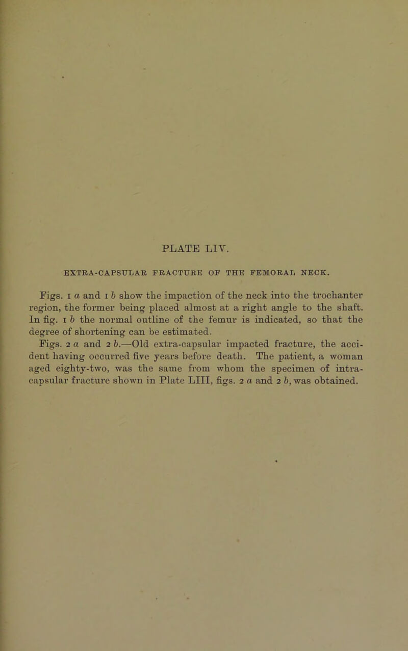 EXTRA-CAPSULAR FRACTURE OF THE FEMORAL NECK. Figs, i a and i b show the impaction of the neck into the trochanter region, the former being placed almost at a right angle to the shaft. In fig. i b the normal outline of the femur is indicated, so that the degree of shortening can be estimated. Figs. 2 a and 2 b.—Old extra-capsular impacted fracture, the acci- dent having occurred five years before death. The patient, a woman aged eighty-two, was the same from whom the specimen of intra-
