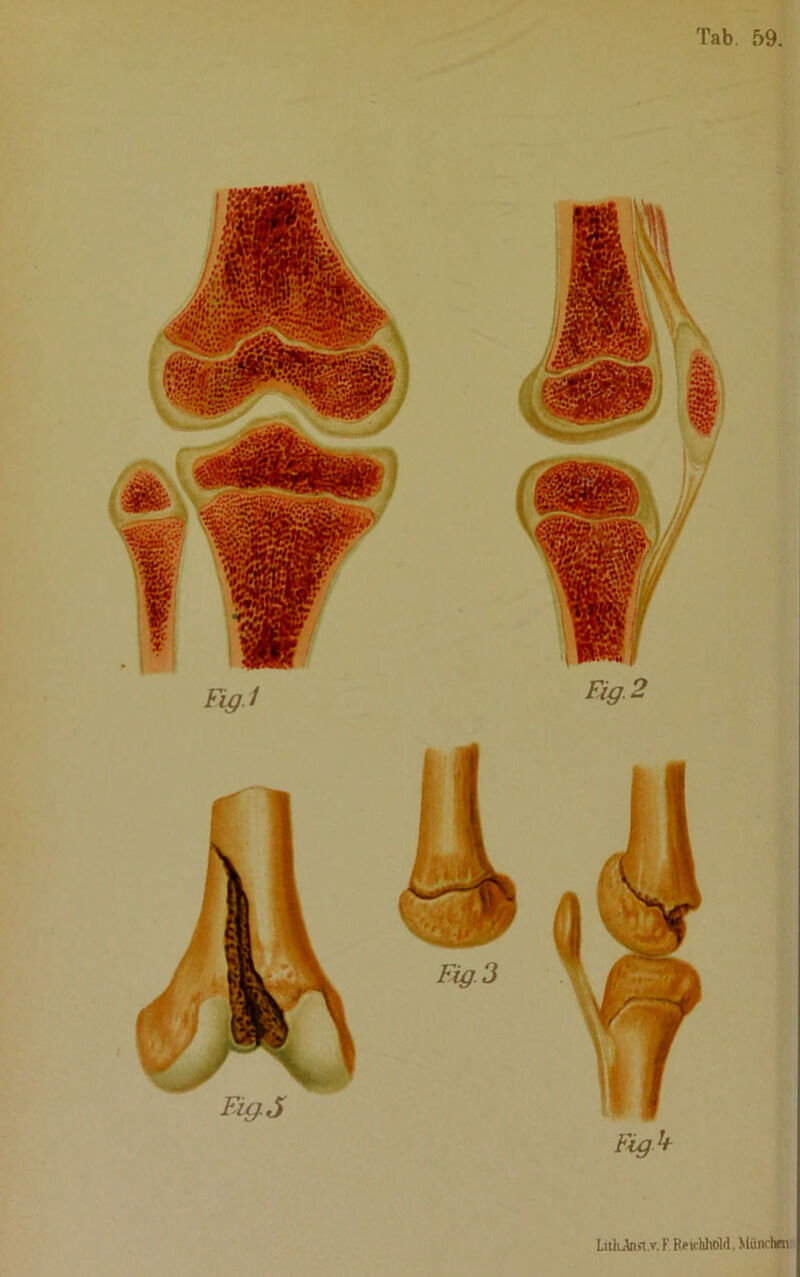 LitkAnsi.v. F. ReicMwlA, Miinchpt
