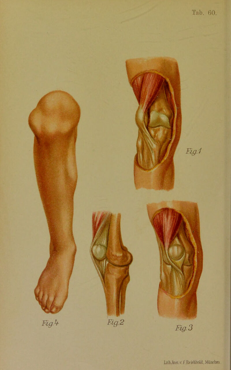 LithJnst .v. (' Rp irWiolrt. Miinrhm