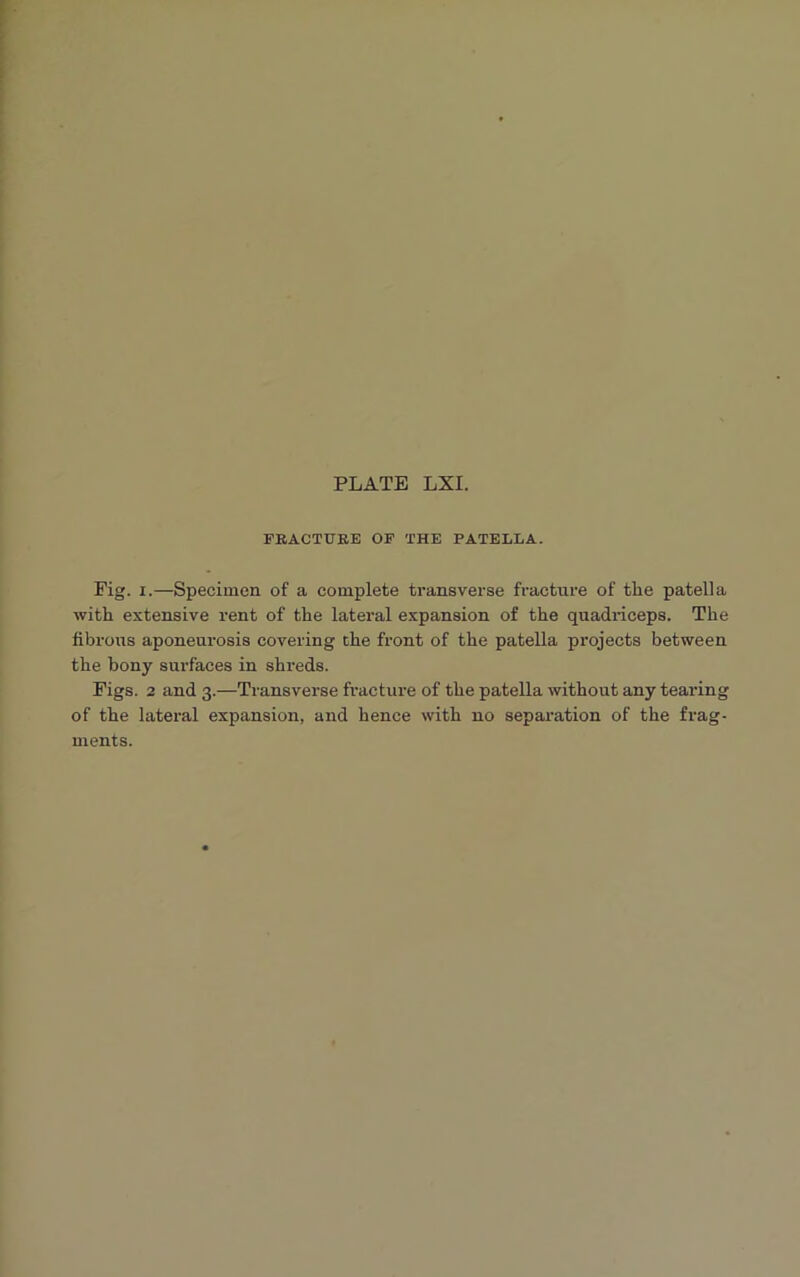 FRACTURE OE THE PATELLA. Pig. i.—Specimen of a complete transverse fracture of the patella with extensive rent of the lateral expansion of the quadriceps. The fibrous aponeurosis covering the front of the patella projects between the bony surfaces in shreds. Figs. 2 and 3.—Transverse fracture of the patella without any tearing of the lateral expansion, and hence with no separation of the frag- ments.