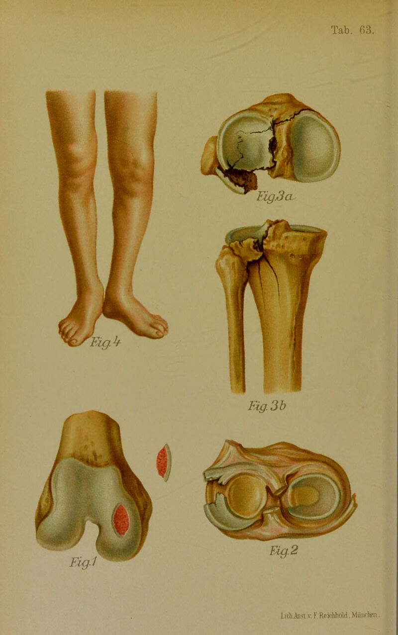 Tab. fi3. Lithiiwt.v. F. Rfidihold. Mfinchcn
