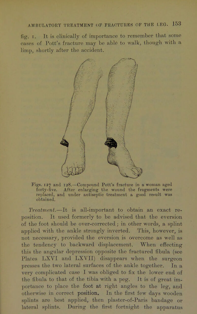 fig. t. It is clinically of importance to remember that some cases of Pott’s fracture may be able to walk, though with a limp, shortly after the accident. Figs. 127 and 128.—Compound Pott's fracture in a woman aged forty-five. After enlarging the wound the fragments were replaced, and under antiseptic treatment a good result was obtained. Treatment.—It is all-important to obtain an exact re- position. It used formerly to be advised that the eversion of the foot should be over-corrected; in other words, a splint applied with the ankle strongly inverted. This, however, is not necessary, provided the eversion is overcome as well as the tendency to backward displacement. When effecting this the angular depression opposite the fractured fibula (see Plates LXVI and LXVII) disappears when the surgeon presses the two lateral surfaces of the ankle together. In a very complicated case I was obliged to fix the lower end of the fibula to that of the tibia with a peg. It is of great im- portance to place the foot at right angles to the leg, and otherwise in correct position. In the first few days wooden splints are best applied, then plaster-of-Pax-is bandage or lateral splints. During the first fortnight the apparatus