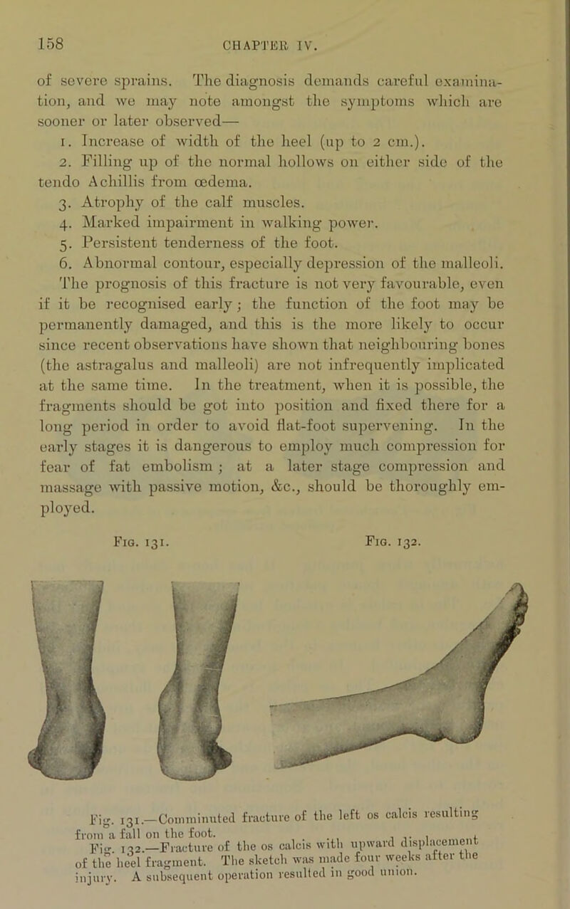 of severe sprains. The diagnosis demands careful examina- tion, and we may note amongst the symptoms which are sooner or later observed— 1. Increase of width of the heel (up to 2 cm.). 2. Filling up of the normal hollows on either side of the tendo A chillis from oedema. 3. Atrophy of the calf muscles. 4. Marked impairment in walking power. 5. Persistent tenderness of the foot. 6. Abnormal contour, especially depression of the malleoli. The prognosis of this fracture is not very favourable, even if it be recognised early; the function of the foot may be permanently damaged, and this is the more likely to occur since recent observations have shown that neighbouring bones (the astragalus and malleoli) are not infrequently implicated at the same time. In the treatment, when it is possible, the fragments should be got iuto position and fixed there for a long period in order to avoid flat-foot supervening. In the early stages it is dangerous to enqdoy much compression for fear of fat embolism ; at a later stage compression and massage with passive motion, &c., should be thoroughly em- ployed. Fig. 131. Fig. 132. Fig. 131.—Comminuted fracture of the left os calcis resulting from a fall on the foot. , . , .. , Fi- 132.—Fracture of the os calcis with upward displacement of the heel fragment. The sketch was made four weeks after the injury. A subsequent operation resulted 111 good union.