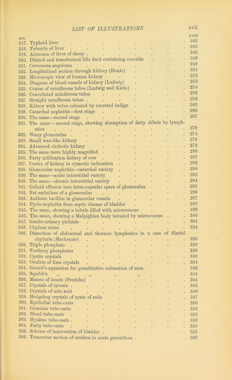 FIG. 317. 318. 319. 320. 321. 322. 323. 324. 325. 326. 327. 328. 329. 330. 331. 332. 333. 334. 335. 336. 337. 338. 339. 340. 341. 342. 343. 344. 345. 346. 347. 348. 349. 350. 351. 352. 353. 354. 355. 356. 357. 358. 359. 360. 361. 362. 363. 364. 365. 366. Typhoid liver ..... Tubercle of liver ..... Adenoma of liver of sheep .... Dilated and transformed bile duct containing coccidia Cavernous angeioma .... Longitudinal section through kidney (Ilenle) Microscopic view of human kidney Diagram of blood-vessels of kidney (Ludwig) Course of uriniferous tubes (Ludwig and Klein) Convoluted uriniferous tubes Straight uriniferous tubes .... Kidney with tubes coloured by excreted indigo Catarrhal nephritis—first stage The same—second stage The same—second stage, showing absorption of fatty debris by atics ...... Waxy glomerulus ..... Small wax-like kidney .... Advanced cirrhotic kidney The same more highly magnified . Fatty infiltration kidney of cow Cortex of kidney in cyanotic induration Glomerular nephritis—catarrhal variety The same—acute interstitial variety The same—chronic interstitial variety Colloid effusion into intra-capsular space of glomerulus Fat embolism of a glomerulus Anthrax bacillus in glomerular vessels Pyelo-nephritis from septic disease of bladder The same, showing a tubule filled with micrococcus The same, showing a Malpighian body invaded by microc Genito-urinary phthisis .... Chylous urine ..... Dissection of abdominal and thoracic lymphatics in a chyluria (Mackenzie) .... Triple phosphate ..... Feathery phosphates .... Cystin crystals ..... Oxalate of lime crystals .... Gerard’s apparatus for quantitative estimation of urea Squibb’s Masses of leucin (Frerichs) Crystals of tyrosin . Crystals of uric acid Hedgehog crystals of urate of soda Epithelial tube-casts Granular tube-casts Blood tube-casts lymph occus case of filarial Hyaline tube-casts .... Fatty tube-casts .... Scheme of innervation of bladder . Transverse section of urethra in acute gonorrhoea PAGE 242 243 245 246 248 251 252 253 254 256 256 260 266 267 270 274 276 278 280 287 289 290 292 294 295 296 297 298 299 300 304 324 326 329 329 330 334 342 344 345 345 346 347 350 350 350 350 350 355 367