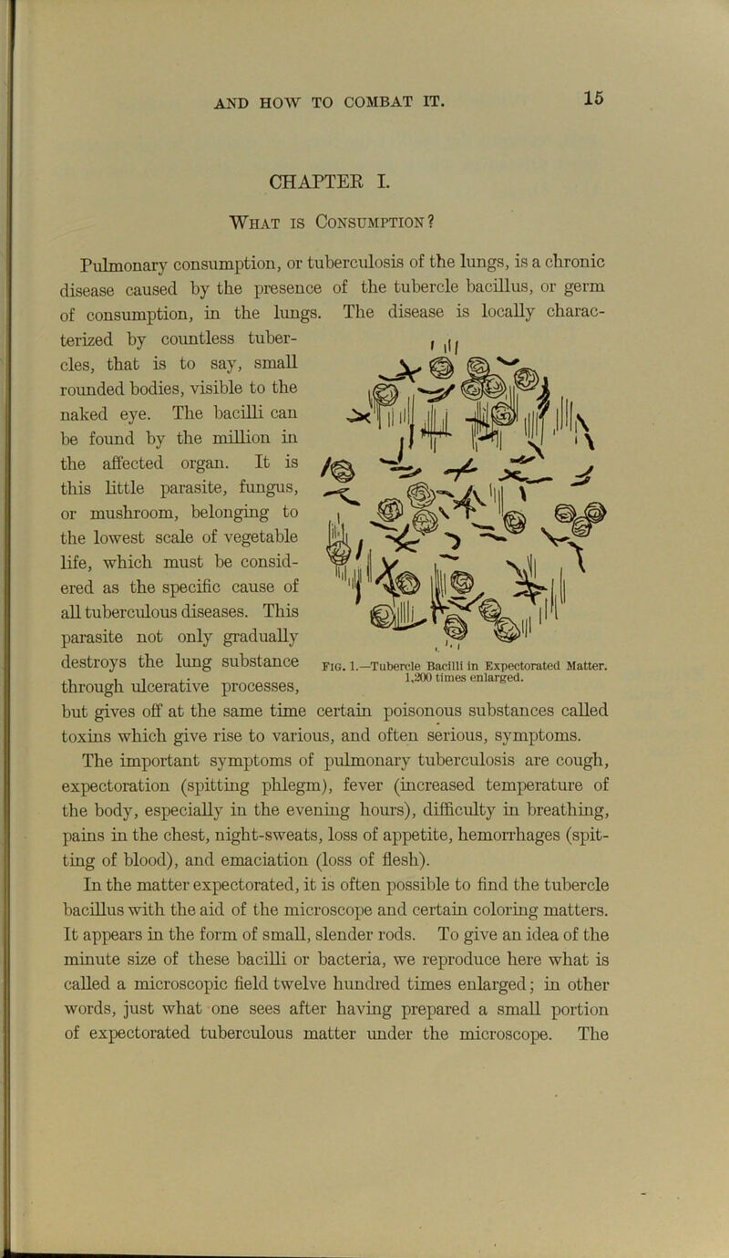 16 CHAPTEK I. What is Consumption? Pulmonary consumption, or tuberculosis of the lungs, is a chronic disease caused by the presence of the tubercle bacillus, or germ of consumption, in the lungs. The disease is locally charac- terised by countless tuber- cles, that is to say, small rounded bodies, visible to the naked eye. The baciQi can be found by the million in the affected organ. It is this little parasite, fungus, or mushroom, belonging to the lowest scale of vegetable life, which must be consid- ered as the specific cause of aU tuberculous diseases. This parasite not only gi-adually destroys the lung substance through ulcerative processes, but gives off at the same time certain poisonous substances called toxins which give rise to various, and often serious, symptoms. The important symptoms of pulmonary tuberculosis are cough, expectoration (spitting plilegm), fever (increased temperature of the body, especially in the evening hours), difficulty in breathing, pains in the chest, night-sweats, loss of appetite, hemonliages (spit- ting of blood), and emaciation (loss of flesh). In the matter expectorated, it is often possible to find the tubercle bacillus with the aid of the microscope and certain coloring matters. It appears in the form of small, slender rods. To give an idea of the minute size of these bacilli or bacteria, we reproduce here what is called a microscopic field twelve hundred times enlarged; in other words, just what one sees after having prepared a small portion of expectorated tuberculous matter under the microscope. The • ilf Fig. 1.—Tubercle Bacilli In Expectorated Matter. 1,200 times enlarged.