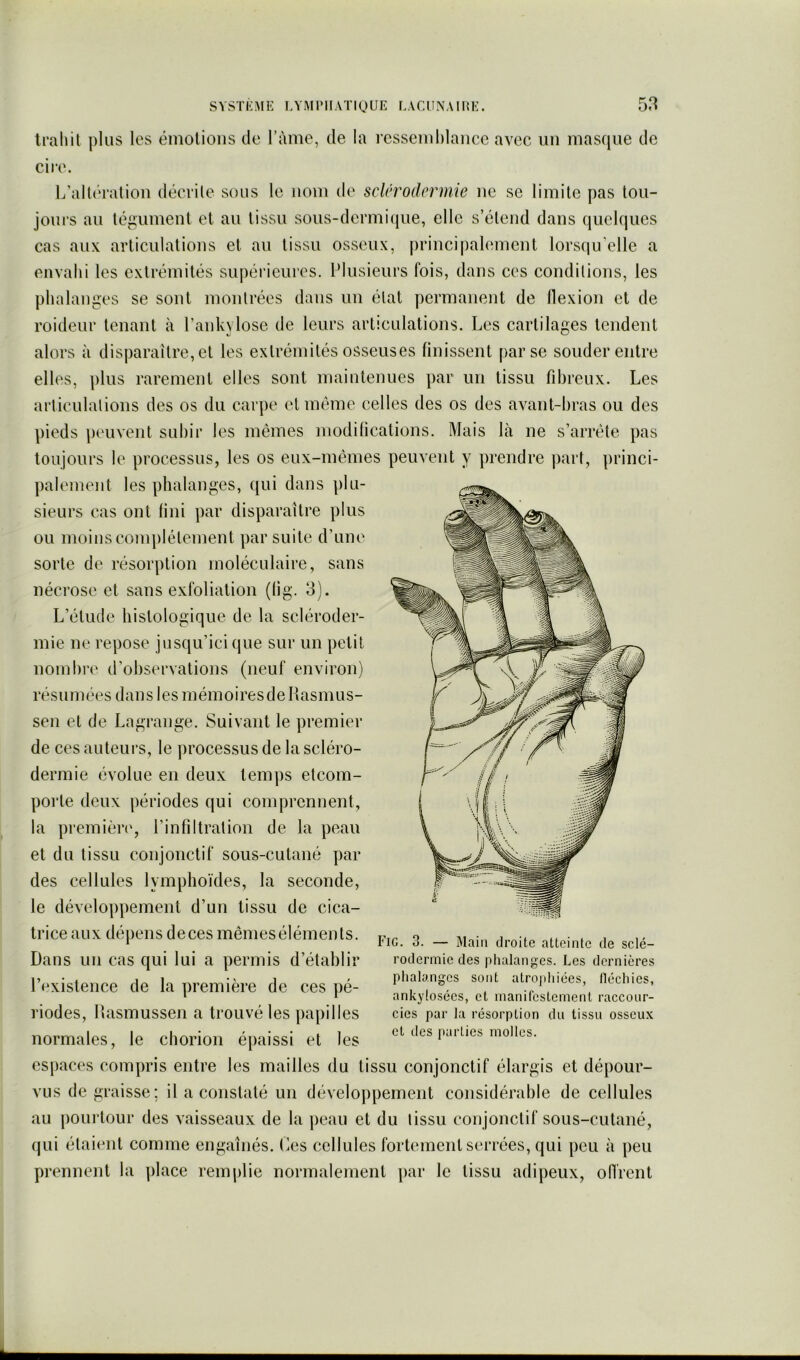 Iraliil ])lus les émolioiis de l’àme, de la rcssciiihlancc avec un masque de cire. L’altération décrite sous le nom de sclérodermie ne se limite pas tou- jours au tégument et au tissu sous-dermi(jue, elle s’étend dans quelques cas aux articulations et au tissu osseux, principaLnnent lorsqu’elle a emahi les extrémités supérieures. Plusieurs fois, dans ces conditions, les phalanges se sont montrées dans un état ])ermanent de llexion et de roideur tenant à Pankylose de leurs articulations. Les cartilages tendent alors à disparaître, et les extrémités osseuses finissent par se souder entre elles, plus rarement elles sont maintenues par un tissu fibreux. Les articulations des os du carpe et meme celles des os des avant-bras ou des pieds peuvent subir les mêmes modilications. Mais là ne s’arrête pas toujours le processus, les os eux-mêmes peuvent y prendre part, princi- palement les phalanges, qui dans plu- sieurs cas ont fini par disparaître plus ou moins complètement par suite d’une sorte de résorption moléculaire, sans nécrose et sans exfoliation (fig. 3). L’étude histologique de la scléroder- mie ne repose jusqu’ici que sur un petit nombre d’observations (neuf environ) résumées dans les mémoires de Rasmus- sen et de Lagrange. Suivant le premier de ces auteurs, le processus de la scléro- dermie évolue en deux tem])s elcom- poi’te deux périodes qui comprennent, la premièn', l’infiltration de la peau et du tissu conjonctif sous-cutané par des cellules lymphoïdes, la seconde, le développement d’un tissu de cica- trice au X dépens de ces mêmes éléinen ts. Dans un cas qui lui a permis d’établir l’existence de la première de ces pé- riodes, Rasmussen a trouvé les papilles normales, le cborion épaissi et les espaces compris entre les mailles du tissu conjonctif élargis et dépour- vus de graisse; il a constaté un dévelojipement considérable de cellules au |)Oui‘tour des vaisseaux de la peau et du tissu conjonctif sous-cutané, qui étaient comme engainés. Les cellules fortement serrées, qui peu à peu prennent la ])lace remplie normalement ])ar le tissu adipeux, ofi'rent Fig. 3. — Main droite atteinte de sclé- rodermie des phalanges. Les dernières phalanges sont atroj)hiées, fléchies, ankylosées, et manifestement raccour- cies par la résorption du tissu osseux et des parties molles.