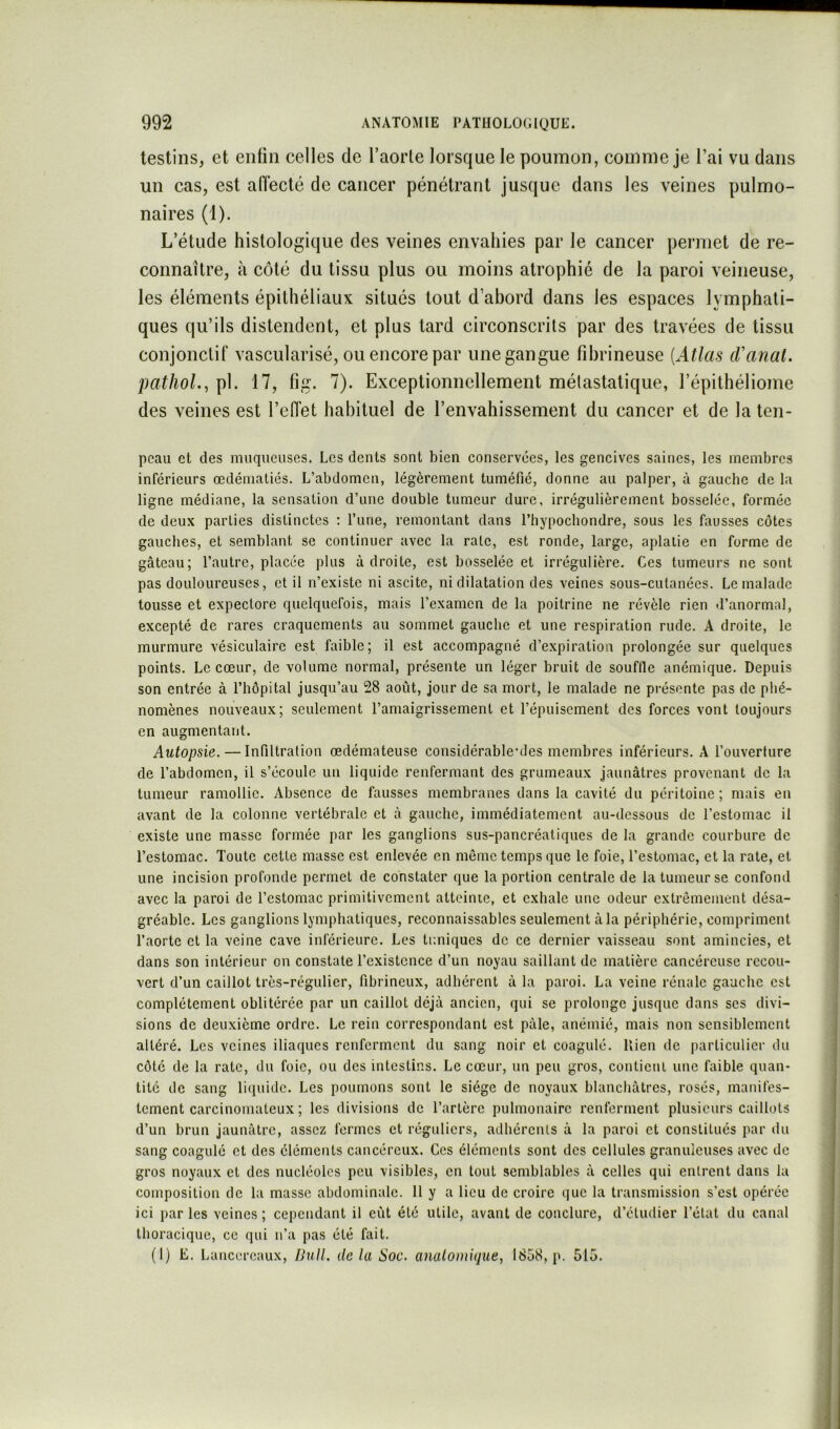 lestins, et enfin celles de l’aorle lorsque le poumon, comme je l’ai vu dans un cas, est adecté de cancer pénétrant jusque dans les veines pulmo- naires (1). L’étude histologique des veines envahies par le cancer permet de re- connaître, à côté du tissu plus ou moins atrophié de la paroi veineuse, les éléments épithéliaux situés tout d’abord dans les espaces lymphati- ques qu’ils distendent, et plus tard circonscrits par des travées de tissu conjonctif vascularisé, ou encore par une gangue fibrineuse [Atlas d'anal. pathoL, pl. 17, fig. 7). Exceptionnellement métastatique, l’épithéliome des veines est l’effet habituel de l’envahissement du cancer et de la ten- pcau et des muqueuses. Les dents sont bien conservées, les gencives saines, les membres inférieurs œdématiés. L’abdomen, légèrement tuméfié, donne au palper, à gauche de la ligne médiane, la sensation d’une double tumeur dure, irrégulièrement bosselée, formée de deux parties distinctes ; l’une, remontant dans l’hypocbondre, sous les fausses côtes gauches, et semblant se continuer avec la rate, est ronde, large, aplatie en forme de gâteau; l’autre, placée plus adroite, est bosselée et irrégulière. Ces tumeurs ne sont pas douloureuses, et il n’existe ni ascite, ni dilatation des veines sous-cutanées. Le malade tousse et expectore quelquefois, mais l’examen de la poitrine ne révèle rien d’anormal, excepté de rares craquements au sommet gauche et une respiration rude. A droite, le murmure vésiculaire est faible; il est accompagné d’expiration prolongée sur quelques points. Le cœur, de volume normal, présente un léger bruit de souflle anémique. Depuis son entrée à l’hôpital jusqu’au 28 août, jour de sa mort, le malade ne présente pas de phé- nomènes nouveaux; seulement l’amaigrissement et l’épuisement des forces vont toujours en augmentant. Autopsie. — Infiltration œdémateuse considérablenles membres inférieurs. A l’ouverture de l’abdomen, il s’écoule un liquide renfermant des grumeaux jaunâtres provenant de la tumeur ramollie. Absence de fausses membranes dans la cavité du péritoine; mais en avant de la colonne vertébrale et à gauche, immédiatement au-dessous de l’estomac il existe une masse formée par les ganglions sus-pancréatiques de la grande courbure de l’estomac. Toute cette masse est enlevée en même temps que le foie, l’estomac, et la rate, et une incision profonde permet de constater que la portion centrale de la tumeur se confond avec la paroi de l’estomac primitivement atteinte, et exhale une odeur extrêmement désa- gréable. Les ganglions lymphatiques, reconnaissables seulement à la périphérie, compriment l’aorte et la veine cave inférieure. Les tuniques de ce dernier vaisseau sont amincies, et dans son intérieur on constate l’existence d’un noyau saillant de matière cancéreuse recou- vert d’un caillot très-régulier, fibrineux, adhérent à la paroi. La veine rénale gauche est complètement oblitérée par un caillot déjà ancien, qui se prolonge jusque dans ses divi- sions de deuxième ordre. Le rein correspondant est pâle, anémié, mais non sensiblement altéré. Les veines iliaques renferment du sang noir et coagulé, llieii de particulier du côté de la rate, du foie, ou des intestins. Le cœur, un peu gros, contient une faible quan- tité de sang ruiuide. Les poumons sont le siège de noyaux blanchâtres, rosés, manifes- tement carcinomateux ; les divisions de l’artère pulmonaire renferment plusieurs caillots d’un brun jaunâtre, assez fermes et réguliers, adhérents à la paroi et constitués par du sang coagulé et des éléments cancéreux. Ces éléments sont des cellules granuleuses avec de gros noyaux et des nucléoles peu visibles, en tout semblables à celles qui entrent dans la composition de la masse abdominale. 11 y a lieu de croire que la transmission s’est opérée ici par les veines ; cependant il eût été utile, avant de conclure, d’étudier l’état du canal thoracique, ce qui n’a pas été fait. (1) E. Lancercaux, IJull. de la Soc. anatomique, 1858, p. 515.