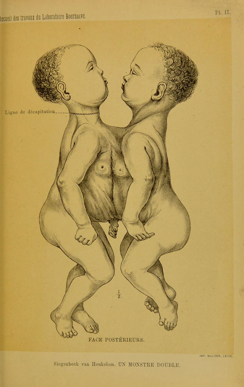 {ecueil des travaux du Laboratoire Boerhaave. IMP. MULOER, LEIDE. Siogcubeek vau Ileukelom. UN MONSTRE DOUBLE. Ligue de décivpitatiuu FACE POSTÉRIEURE.