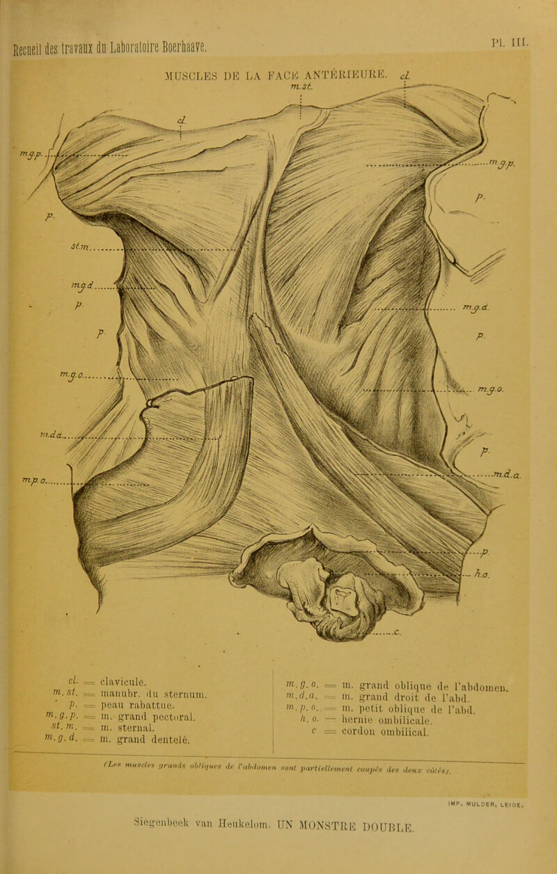 vt.da... m3p. m3P st.ni m3d MUSCLES DE LA FACE ANTÉRIEURE. rn.st. -P - iï.o. - m3° cl. = clavicule. m.st. — manubr. du sternum. p. = peau rabattue. m.g.p. = m. grand pectoral. st.ir,. ~ m. sternal. tn.g.d. = ni. grand dentelé. rLm muscles granits obliques de l'abdomen m.g.o. = m. grand oblique de l’abdomen. m.d.a. m. grand droit de l’abd. m.p.o. , = m. petit oblique de l’abd. h.o. r hernie ombilicale. c = cordon ombilical. sont partiellement coupés des deux côtésj.